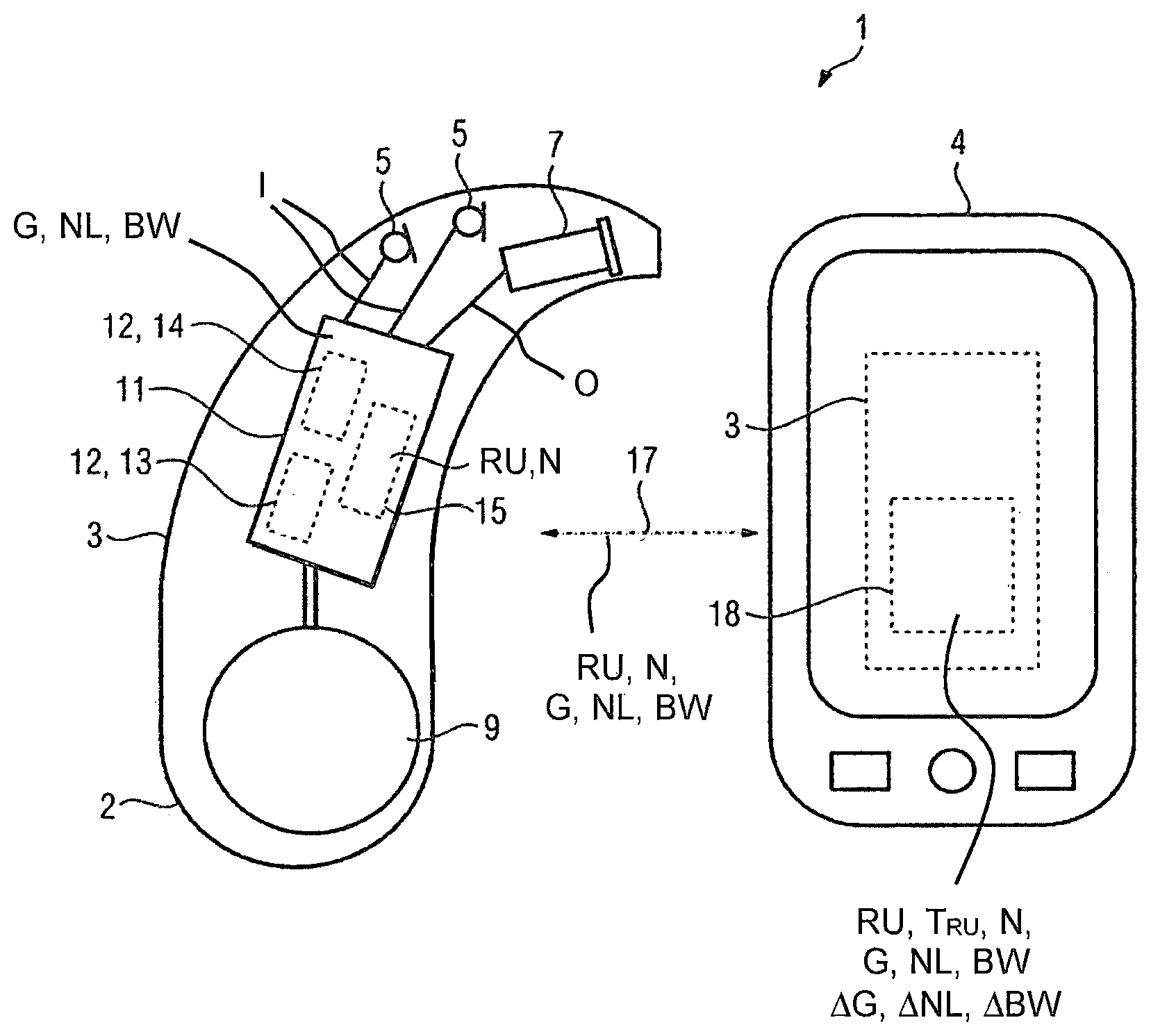 Patent US12309549 Figure 1 – Hearing system containing a hearing instrument and a method for operating the hearing instrument