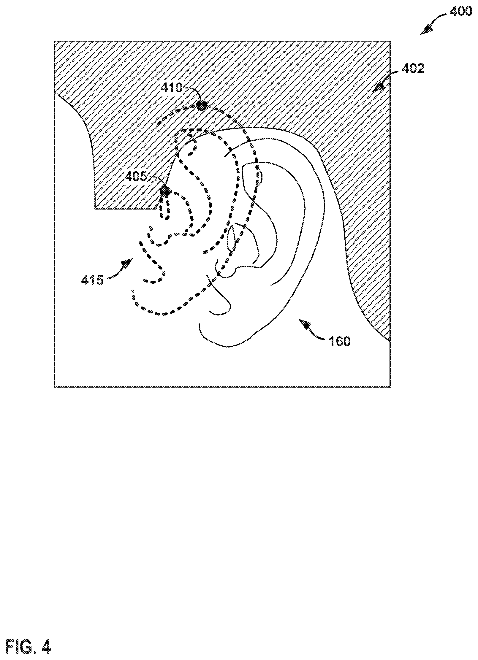 Patent US12309554 Figure 4 – Automatic selection of hearing instrument component size