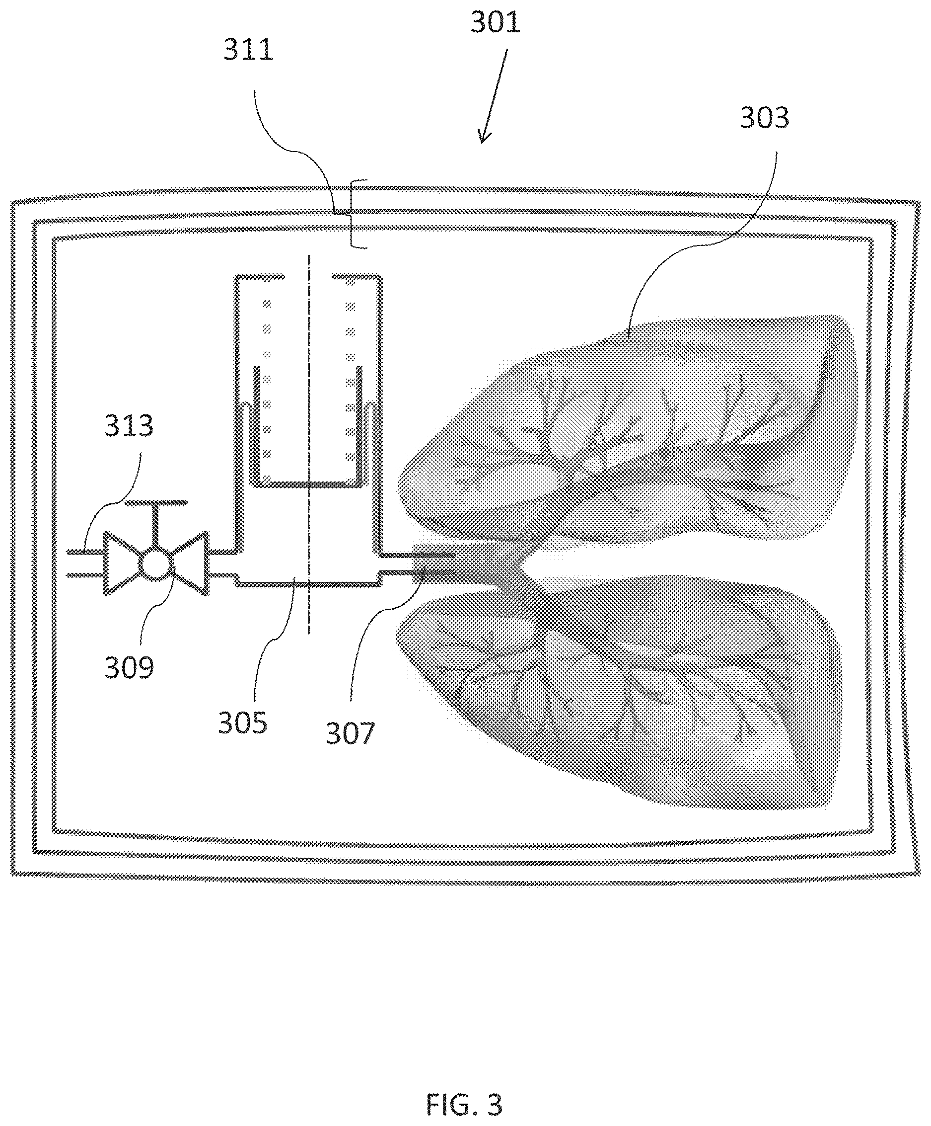 Patent US12310357 Figure 3 – Apparatus for tissue transport and preservation