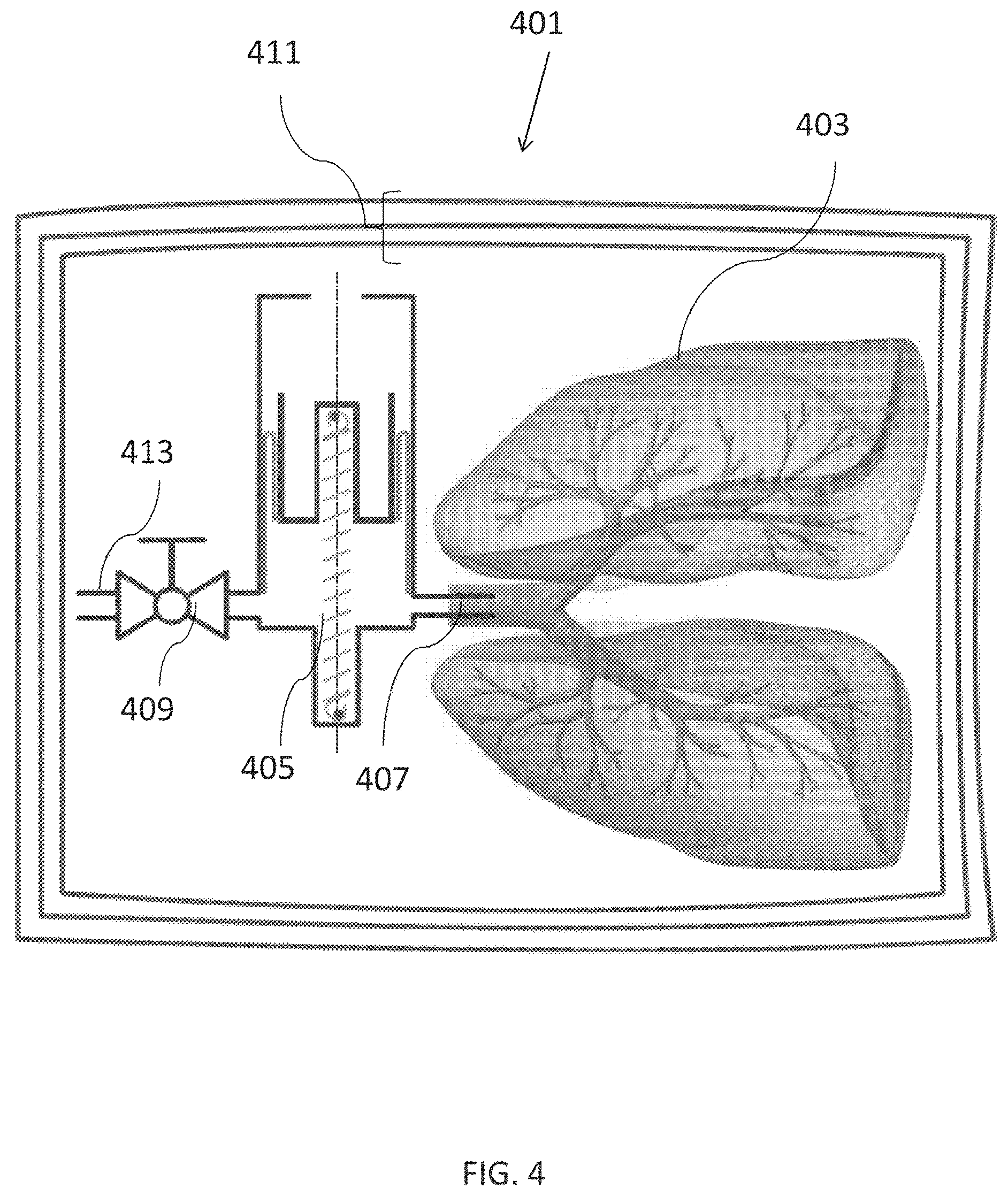 Patent US12310357 Figure 4 – Apparatus for tissue transport and preservation