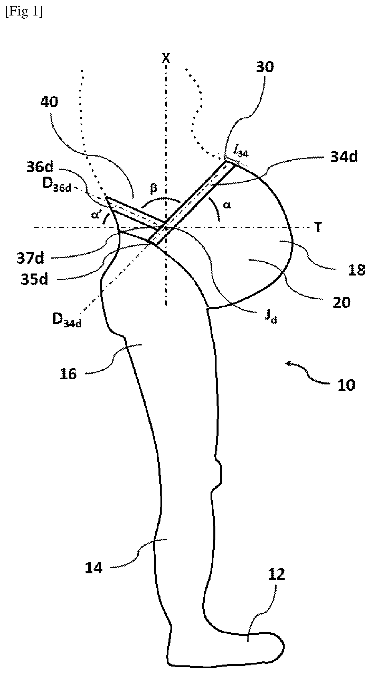 Patent US12310426 Figure 1 – Textile device for pregnant women