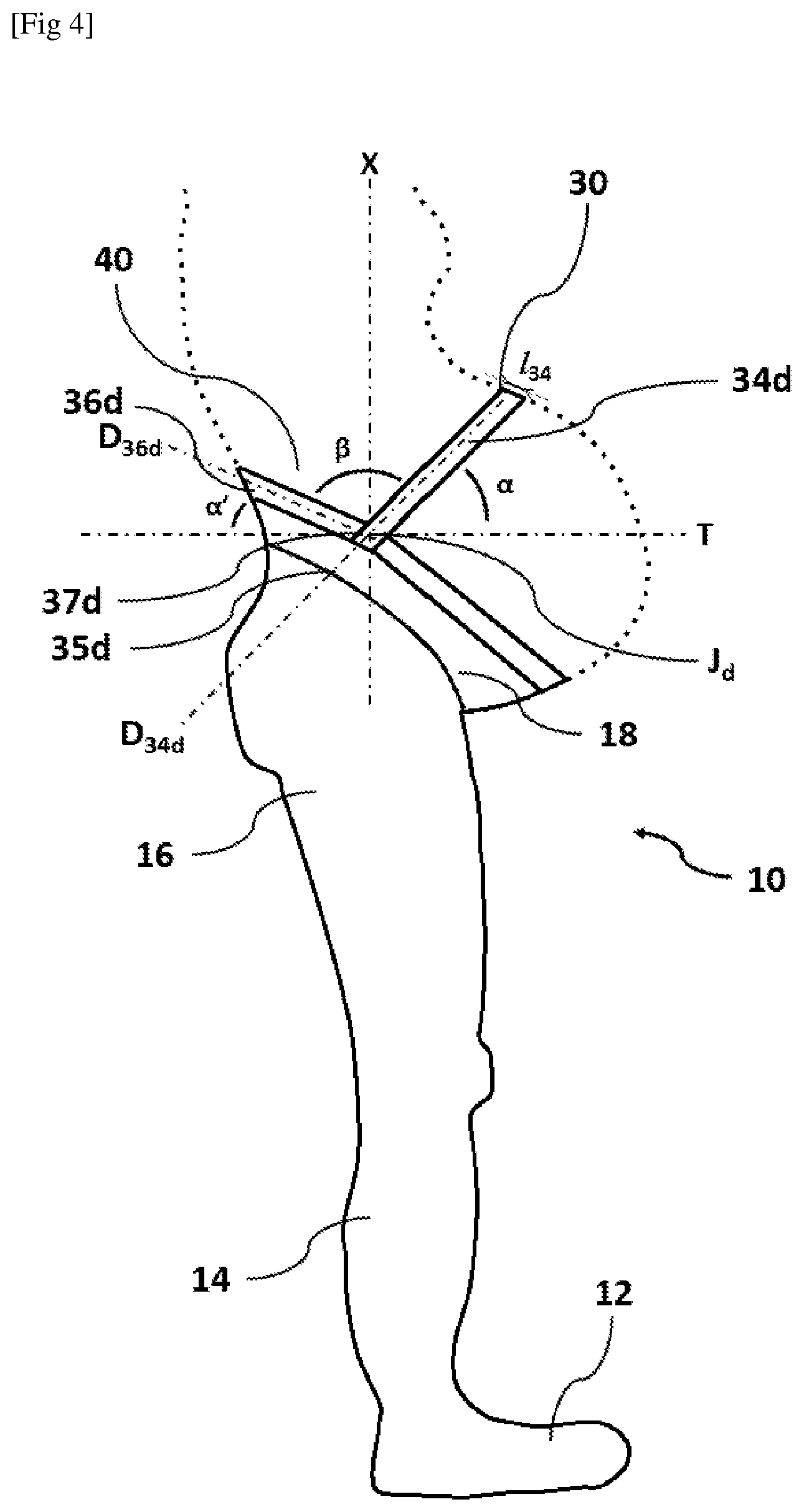 Patent US12310426 Figure 4 – Textile device for pregnant women