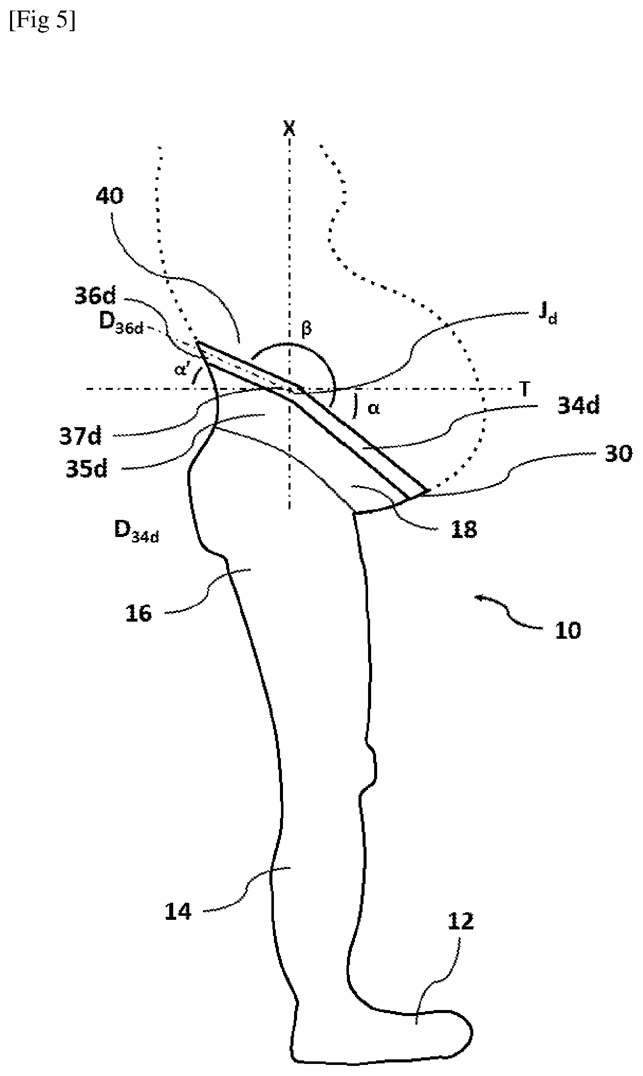 Patent US12310426 Figure 5 – Textile device for pregnant women