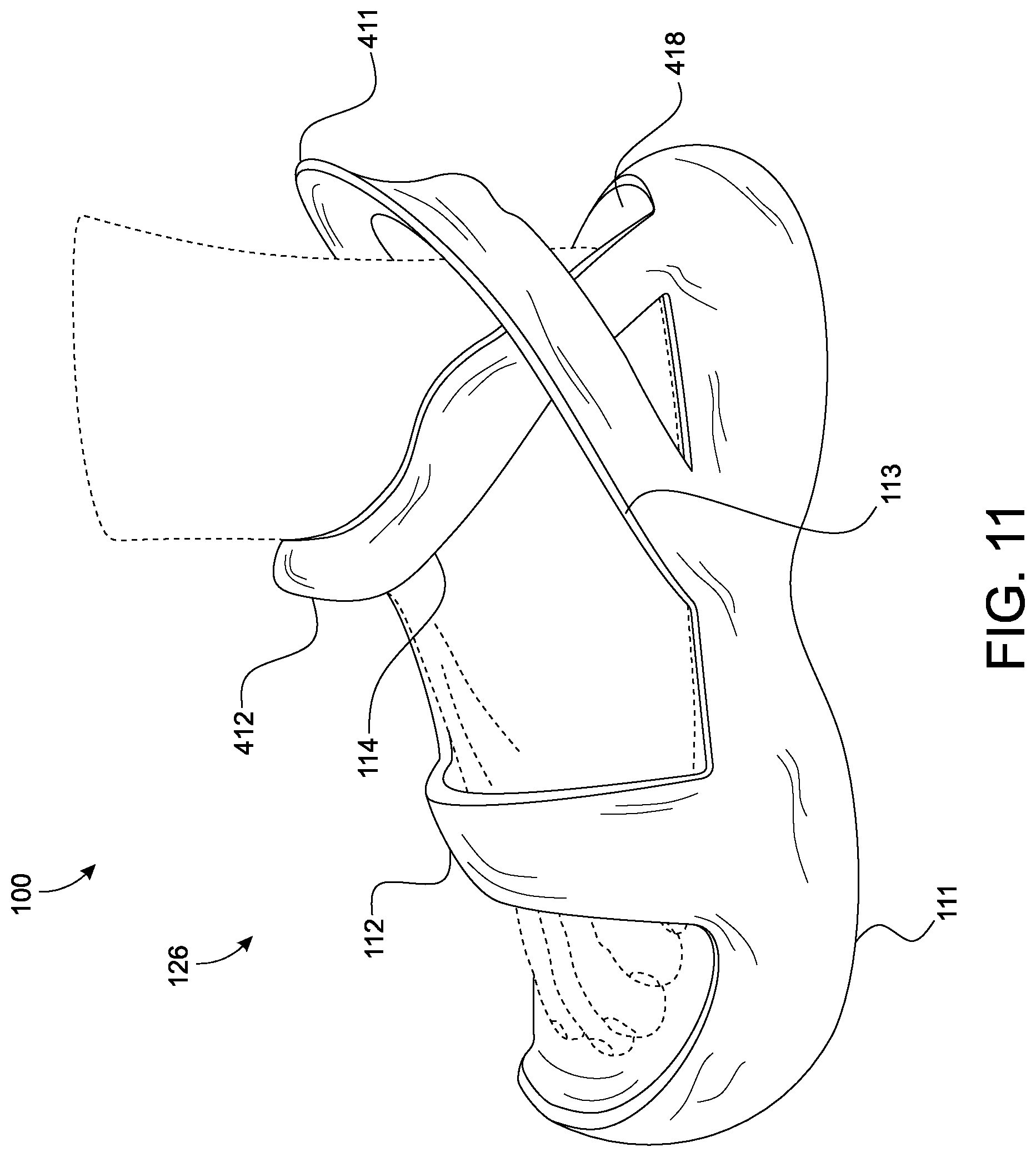 Patent US12310445 Figure 12 – Shoe device with dual stadium arch bimodal structure for rapid entry and release