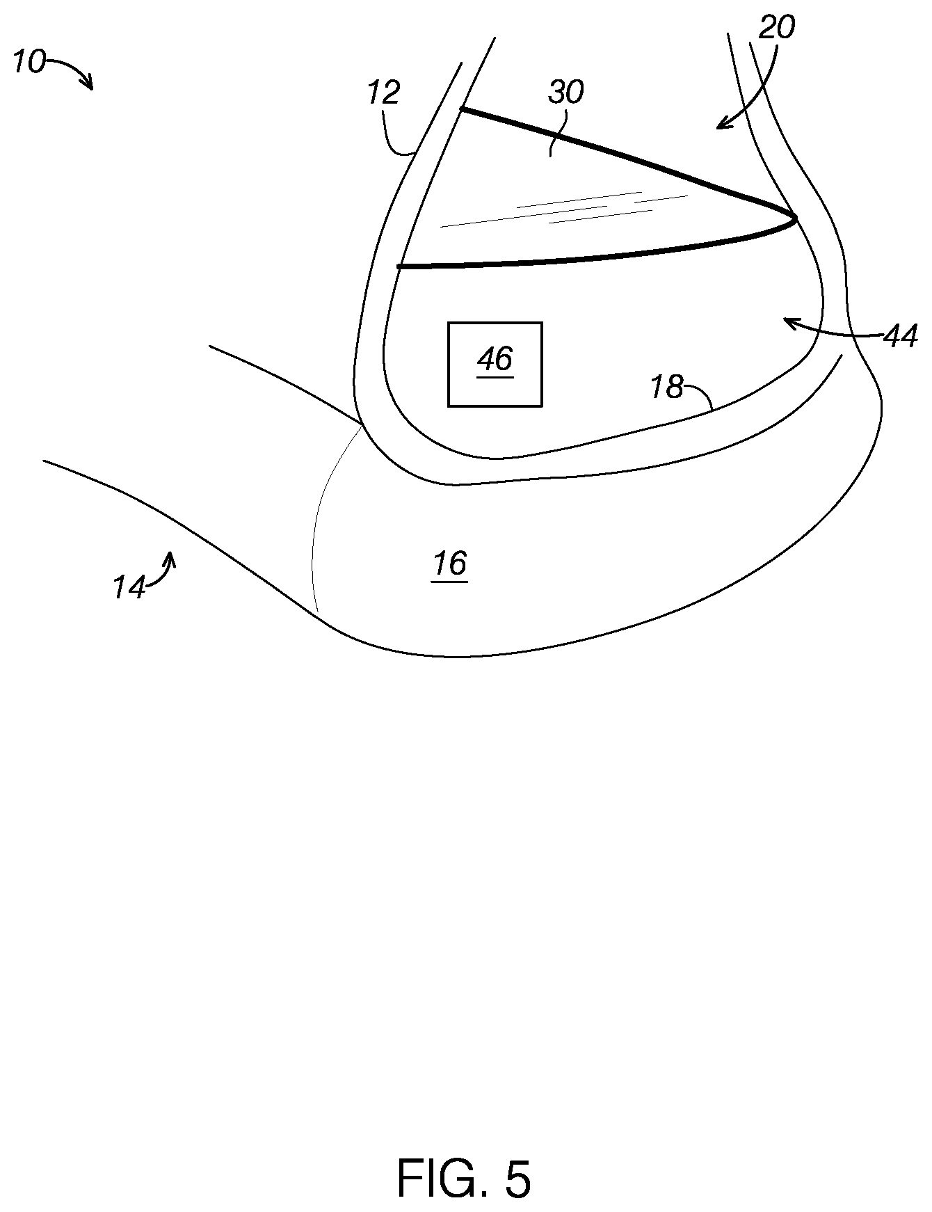 Patent US12310452 Figure 4 – Footwear having a suspended elastic membrane