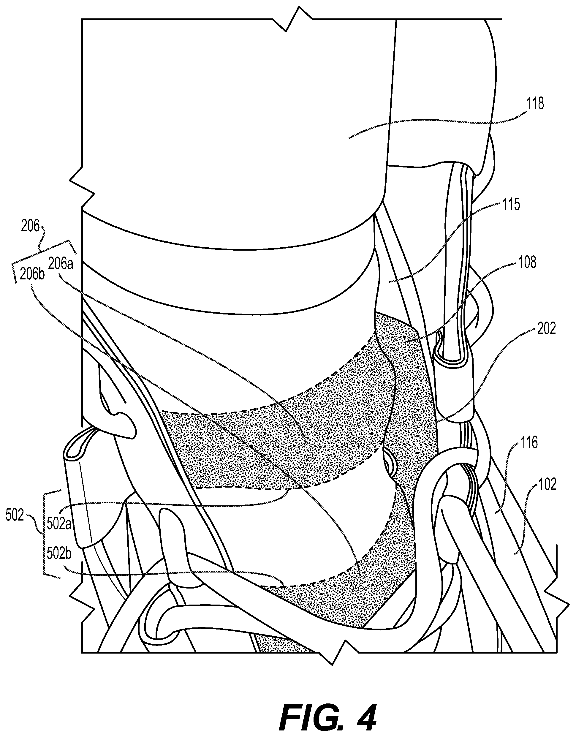 Patent US12310454 Figure 5 – Article of footwear including a support flap