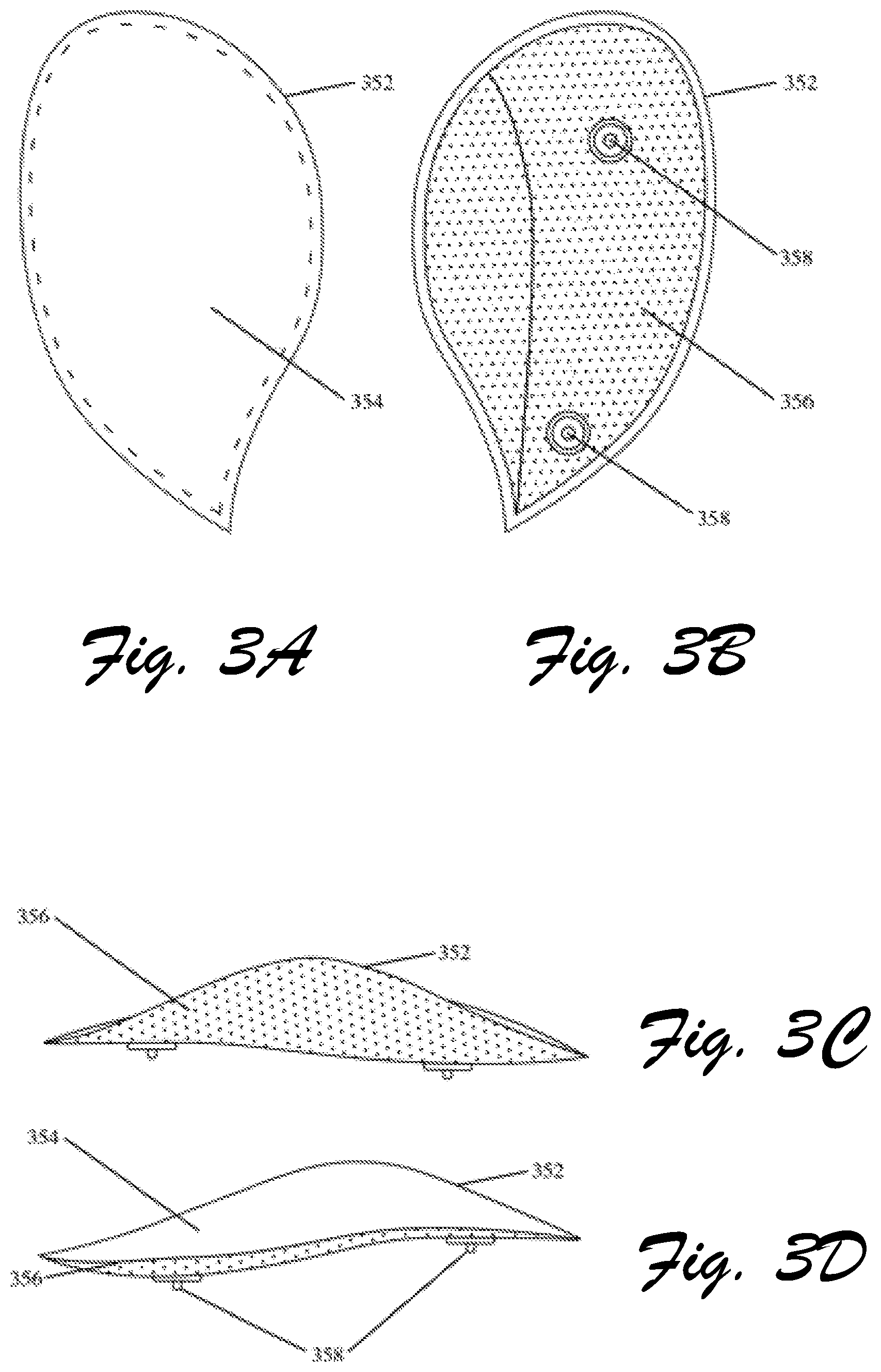 Patent US12310455 Figure 3 – Customizable footwear system