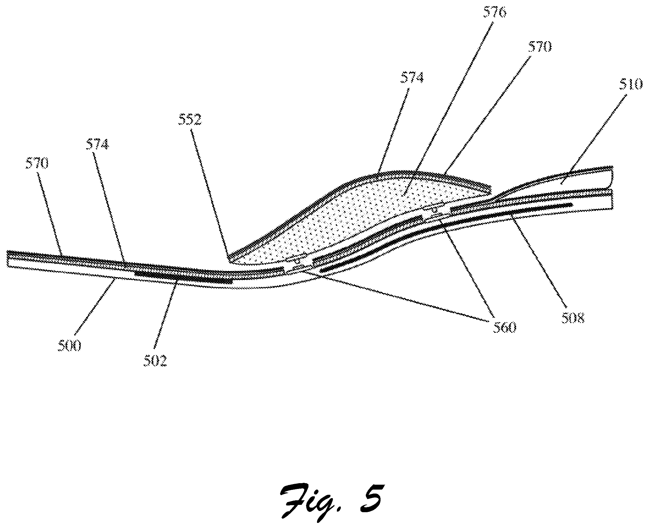 Patent US12310455 Figure 5 – Customizable footwear system