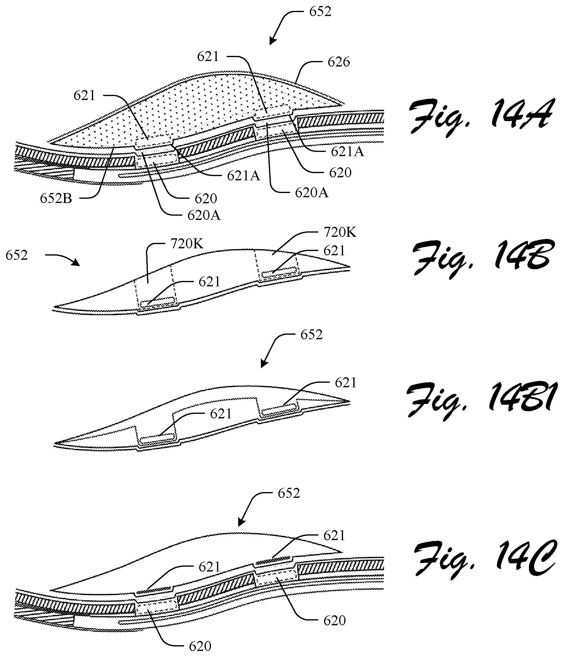 Patent US12310455 Figure 16 – Customizable footwear system