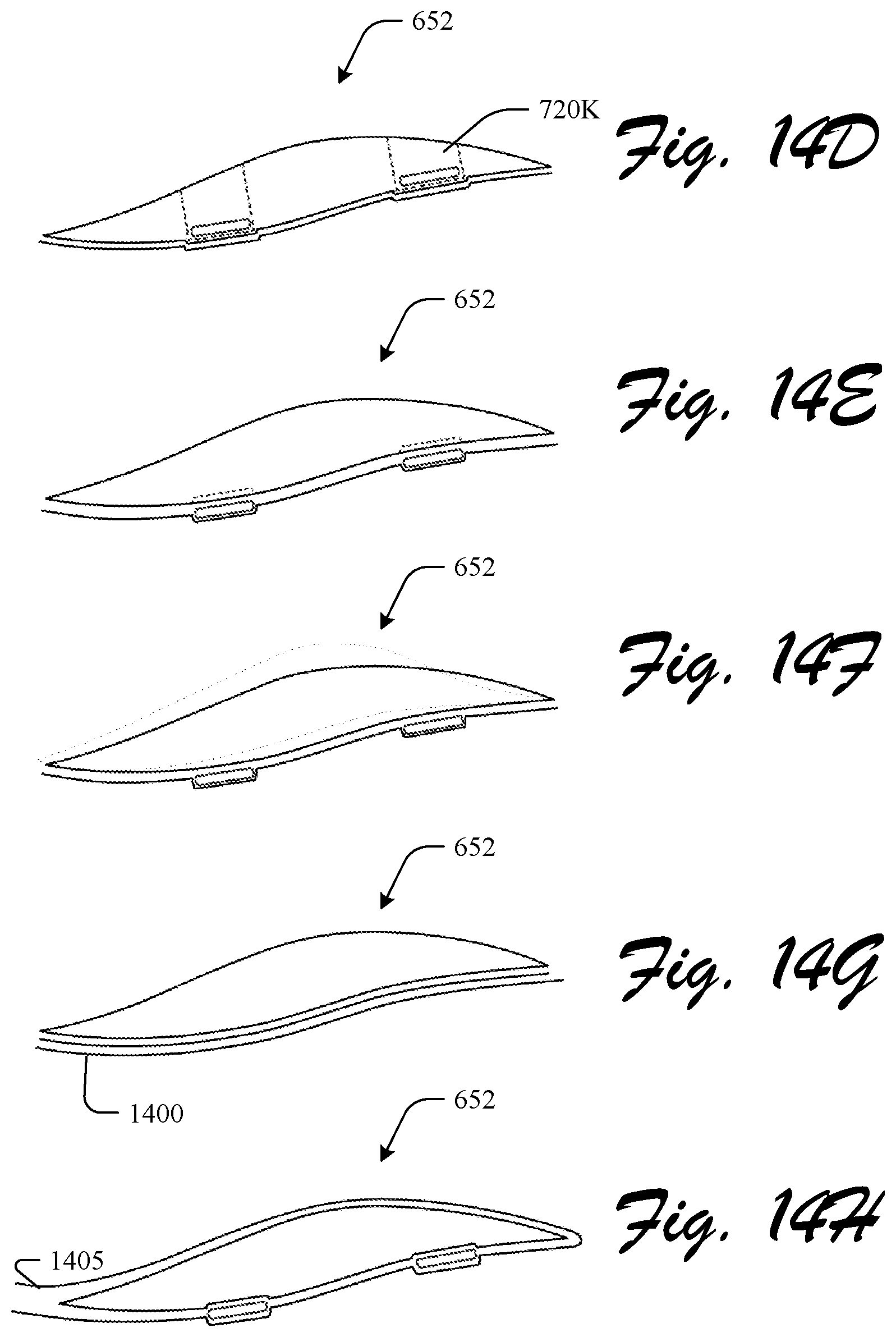 Patent US12310455 Figure 17 – Customizable footwear system