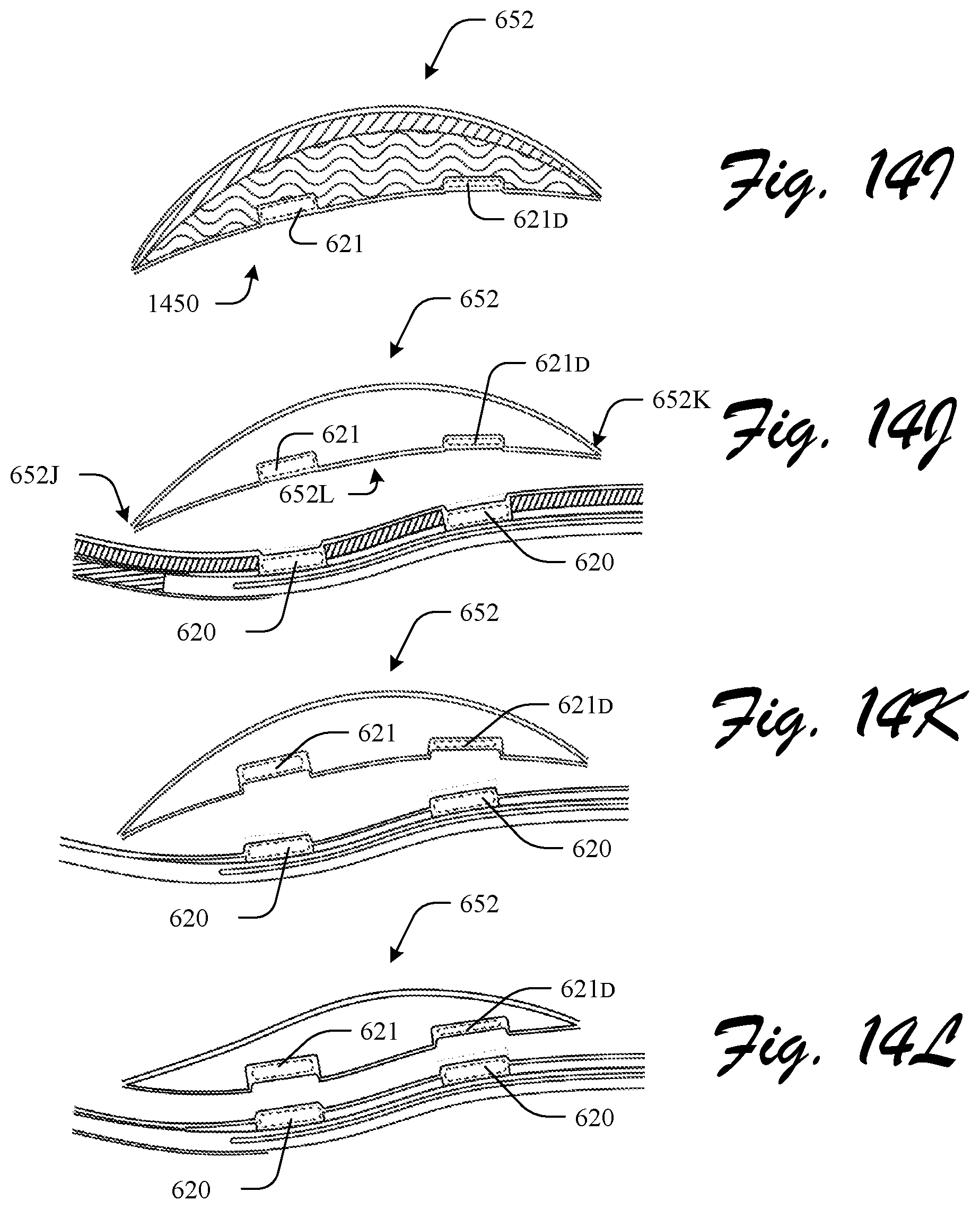Patent US12310455 Figure 18 – Customizable footwear system