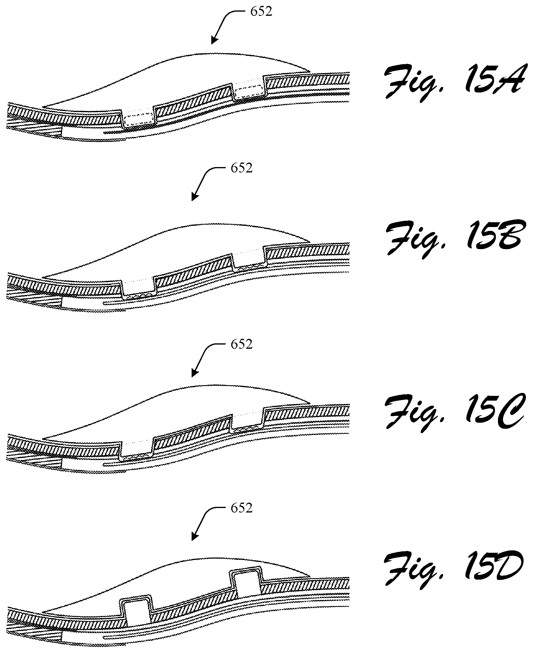 Patent US12310455 Figure 20 – Customizable footwear system