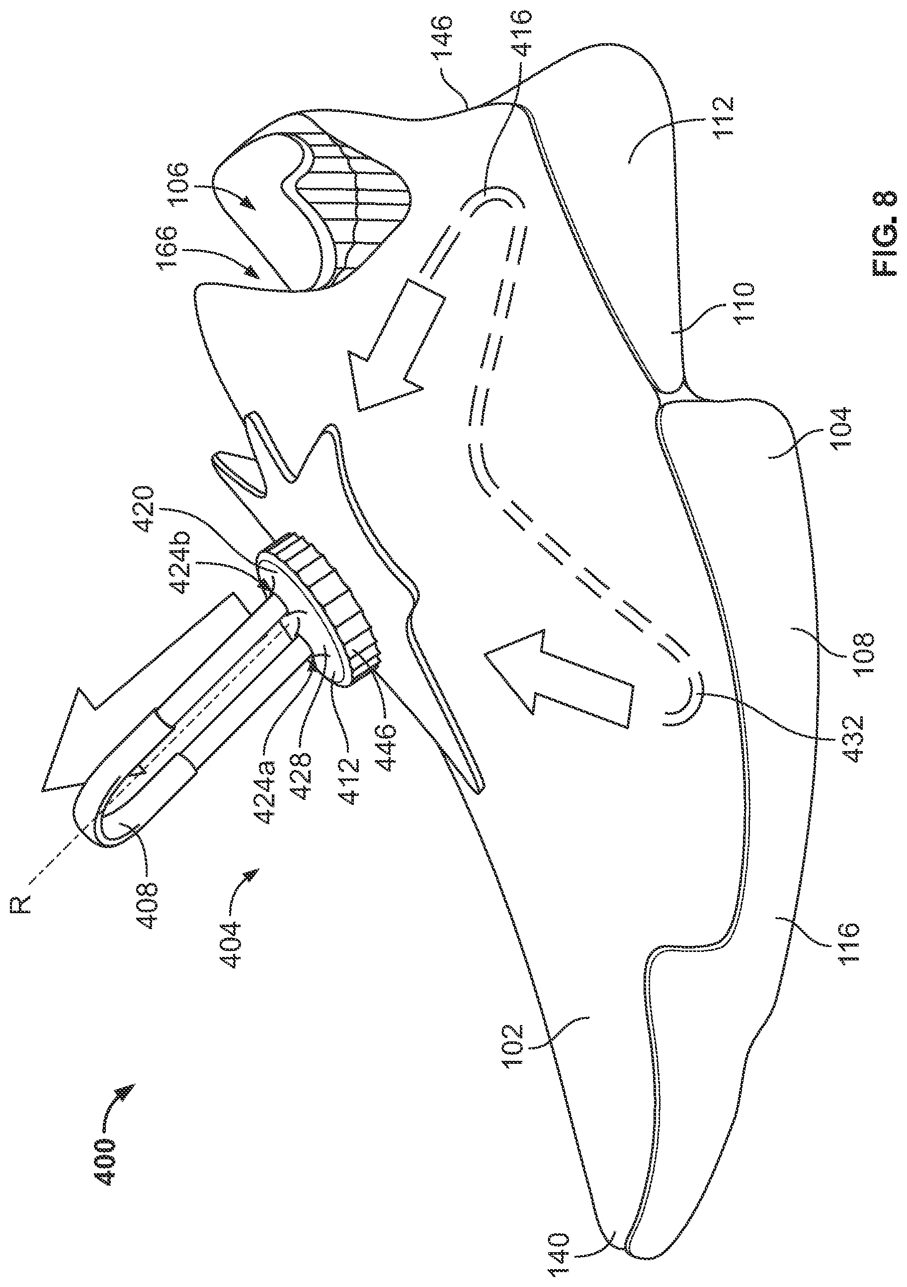 Patent US12310459 Figure 7 – Article of footwear having a closure system