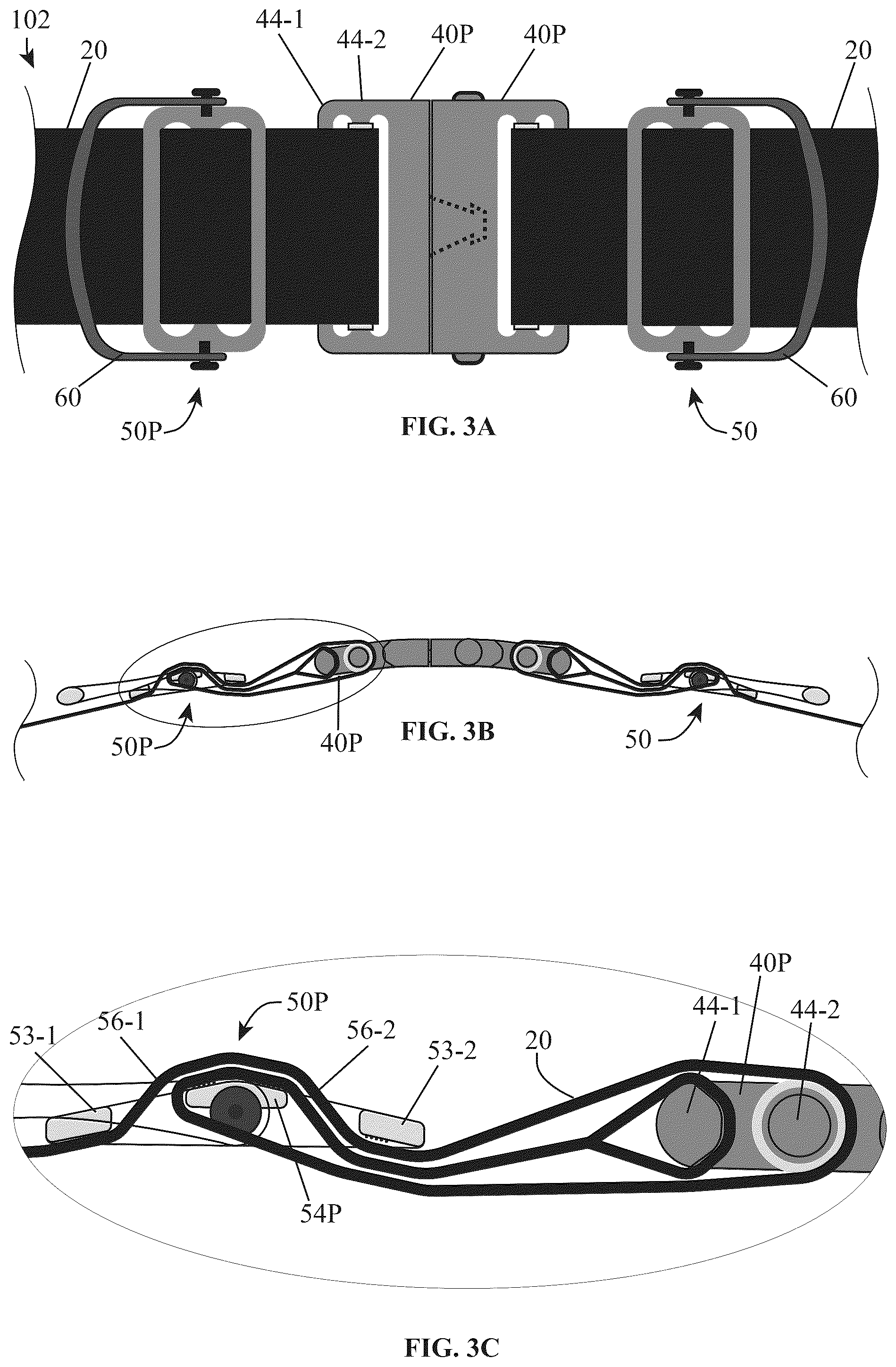 Patent US12310462 Figure 3 – Adjustable closure devices with handle and locking mechanisms