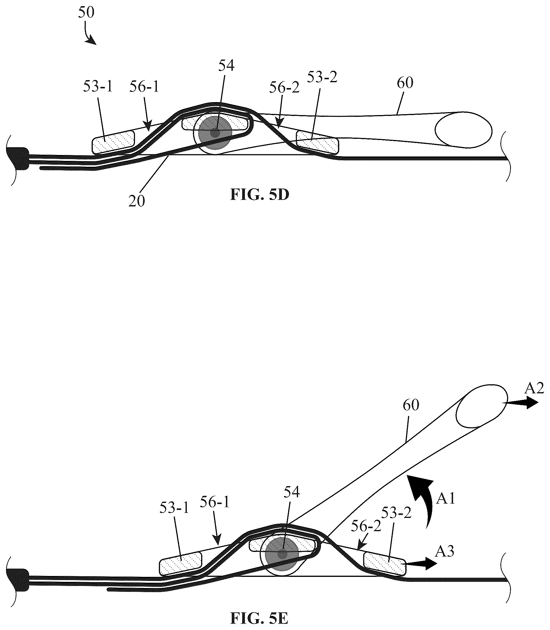 Patent US12310462 Figure 6 – Adjustable closure devices with handle and locking mechanisms