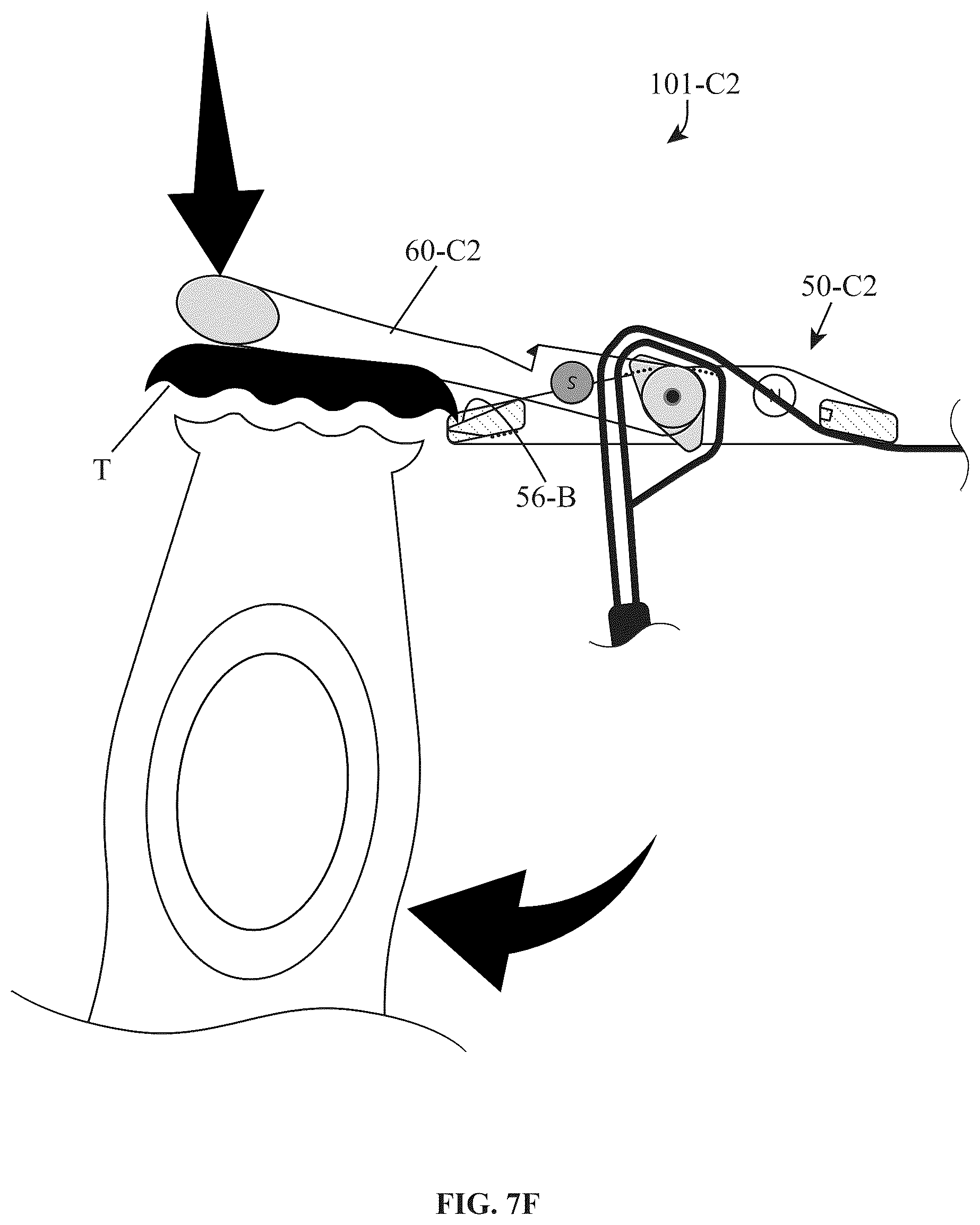 Patent US12310462 Figure 11 – Adjustable closure devices with handle and locking mechanisms