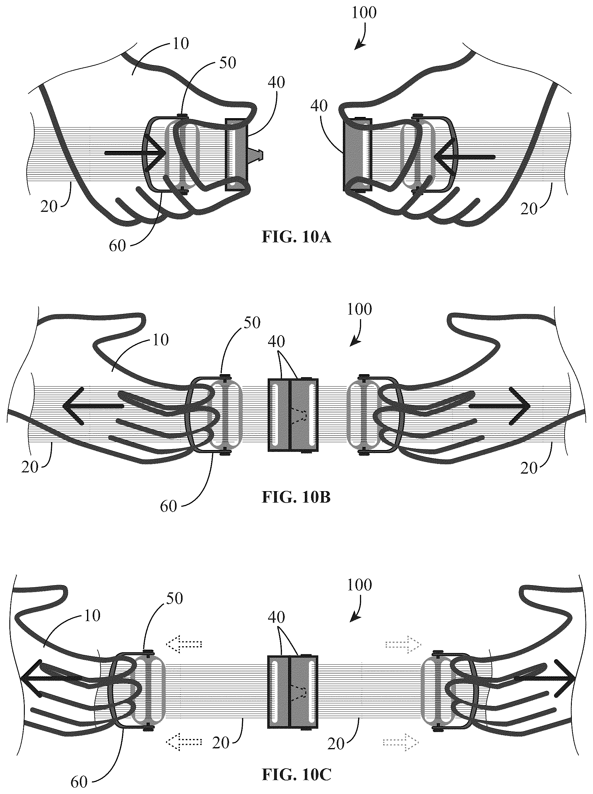 Patent US12310462 Figure 17 – Adjustable closure devices with handle and locking mechanisms