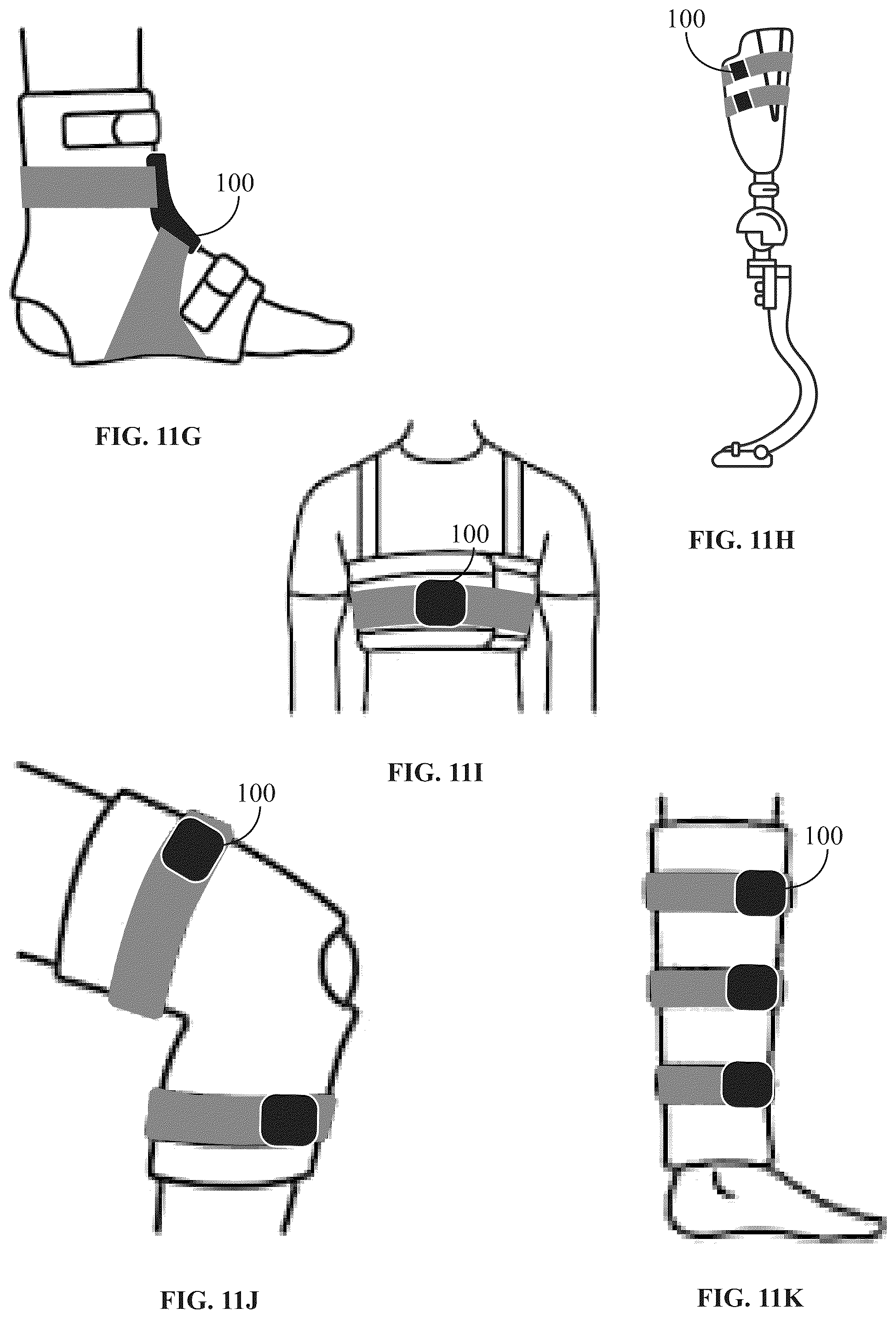 Patent US12310462 Figure 19 – Adjustable closure devices with handle and locking mechanisms