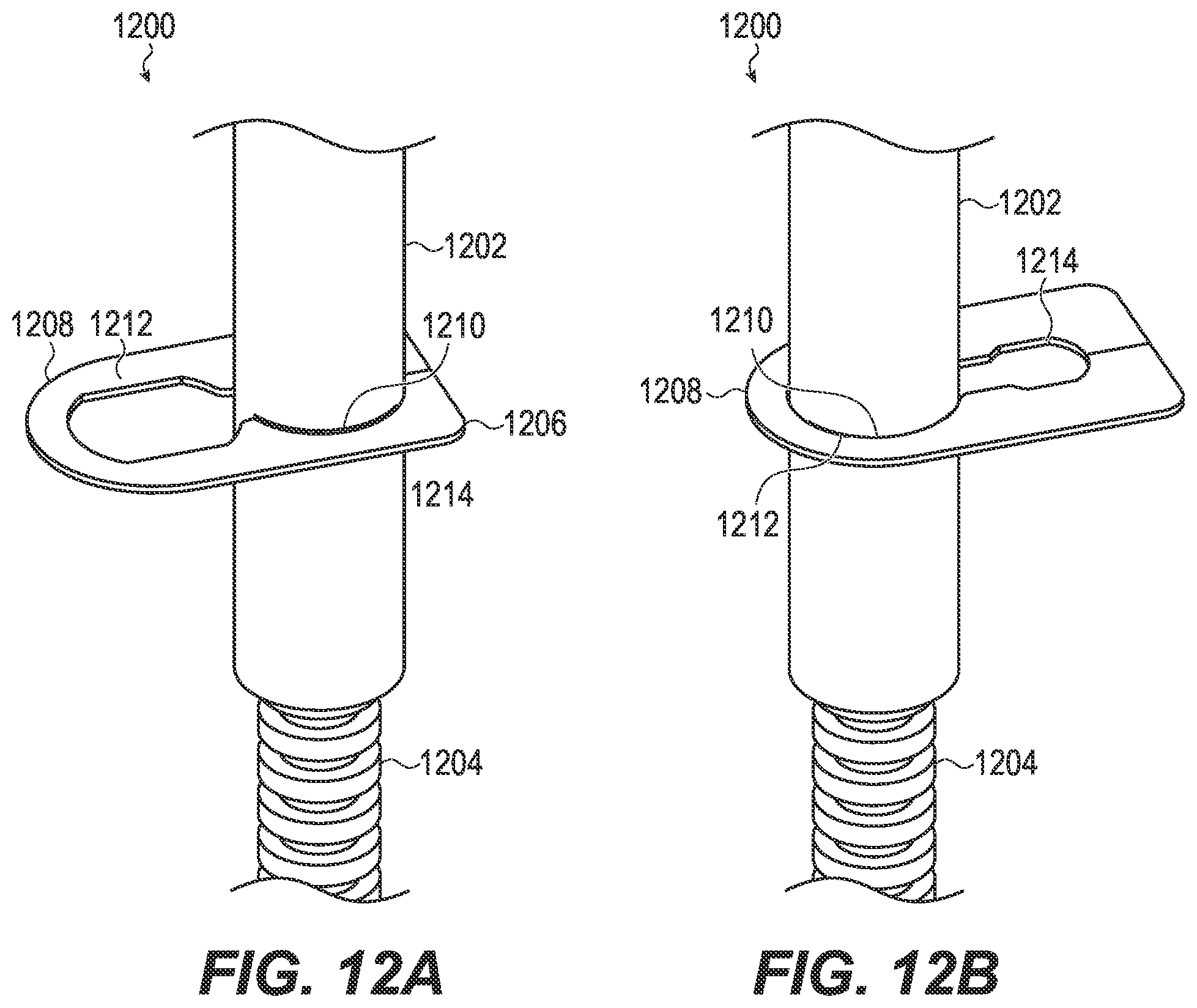 Patent US12310491 Figure 20 – Table with articulable leg system