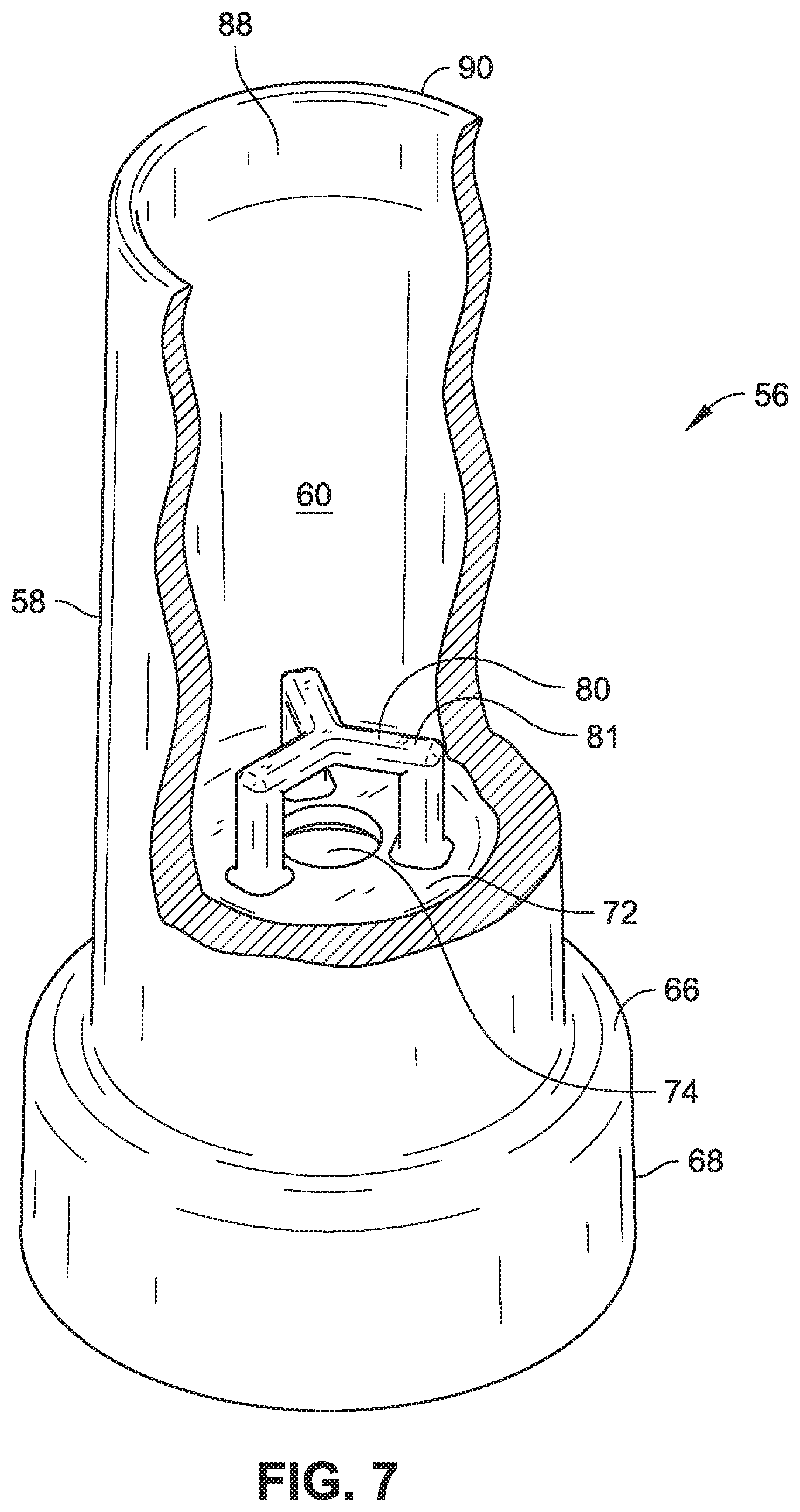 Patent US12310535 Figure 5 – Formulation and dispenser systems for beverage foam toppings