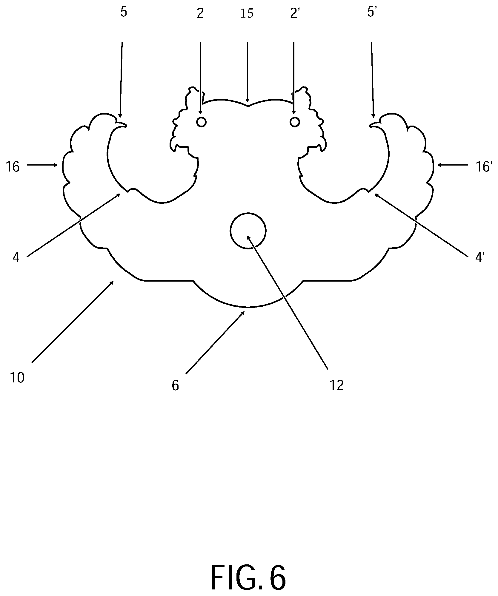 Patent US12310536 Figure 6 – Retaining device for trussing and cooking fowl
