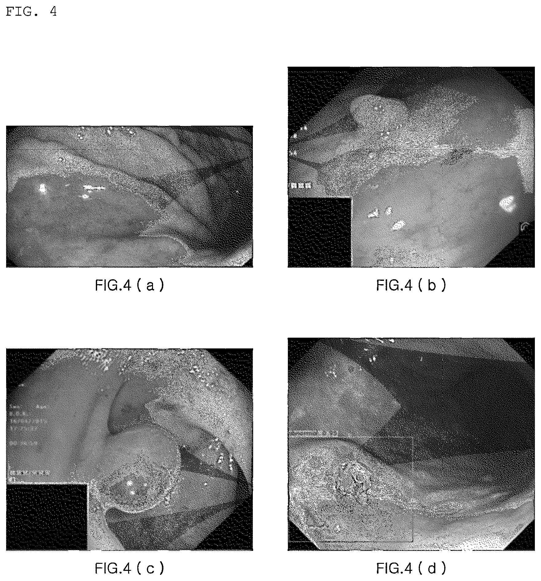 Patent US12310549 Figure 3 – Method of detecting lesions in endoscopic images, and method and computing device for training artificial neural network model that performs the same