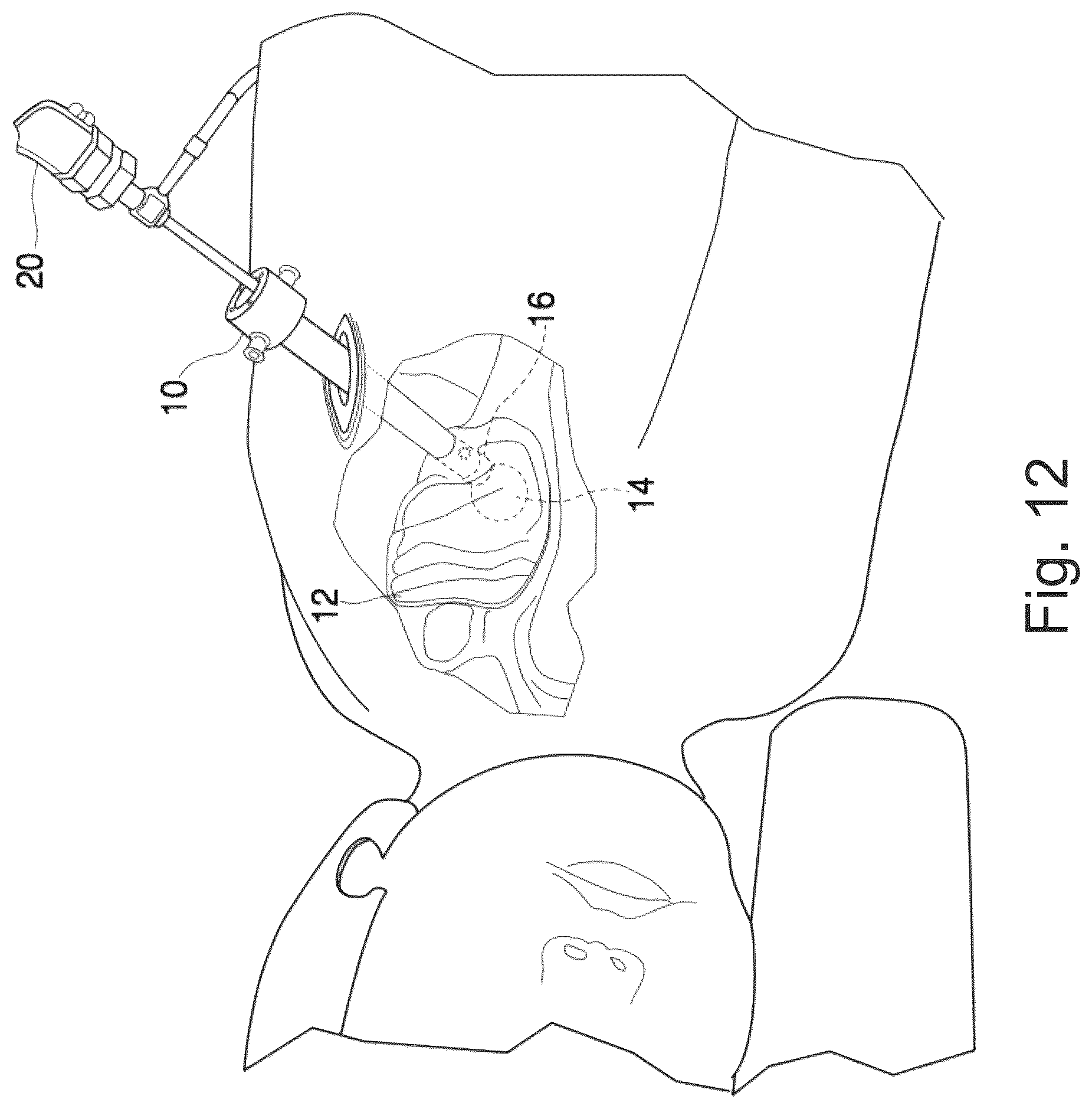 Patent US12310559 Figure 13 – Instrument port with integrated imaging system