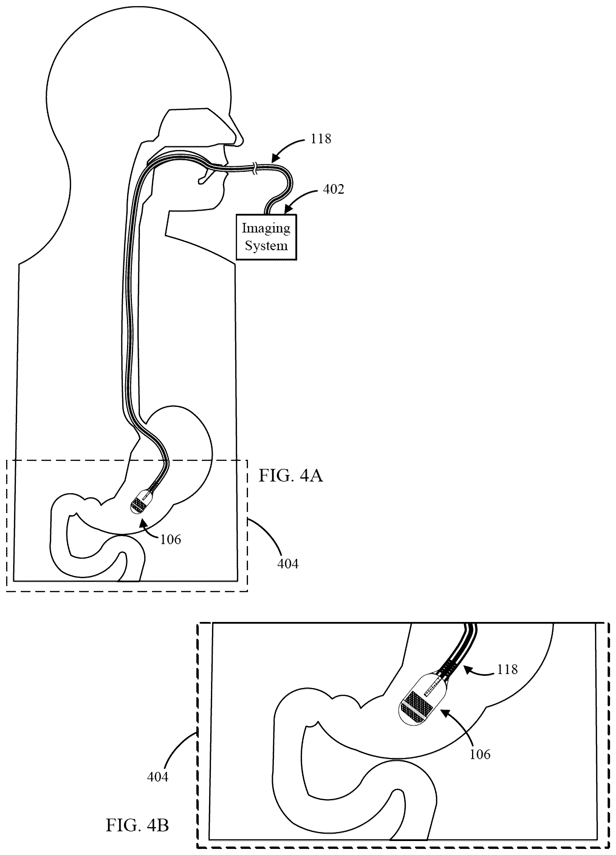 Patent US12310561 Figure 3 – Devices, systems, and methods for advancing and positioning tethered capsule microendoscopes