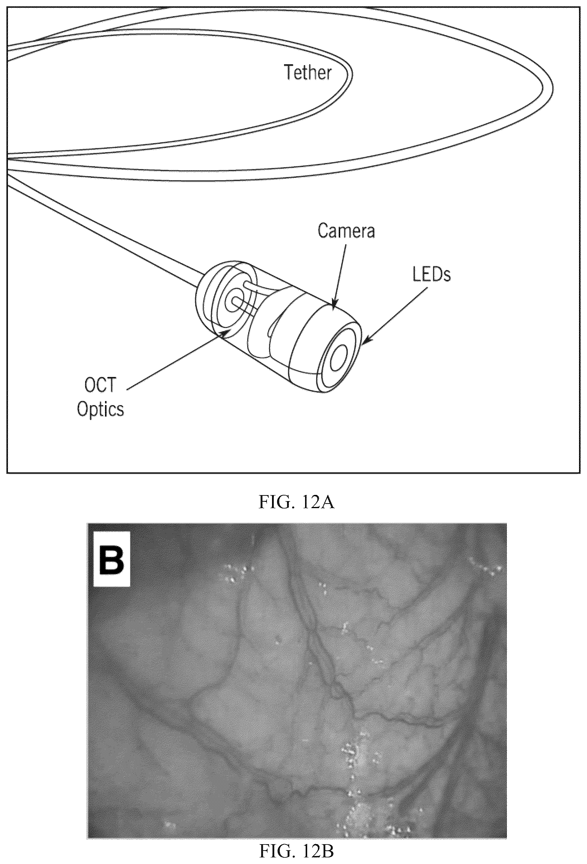 Patent US12310561 Figure 11 – Devices, systems, and methods for advancing and positioning tethered capsule microendoscopes
