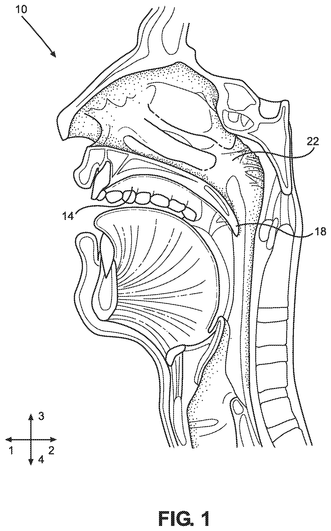 Patent US12310563 Figure 1 – Retrograde endoscope and method for performing intranasal endoscopy