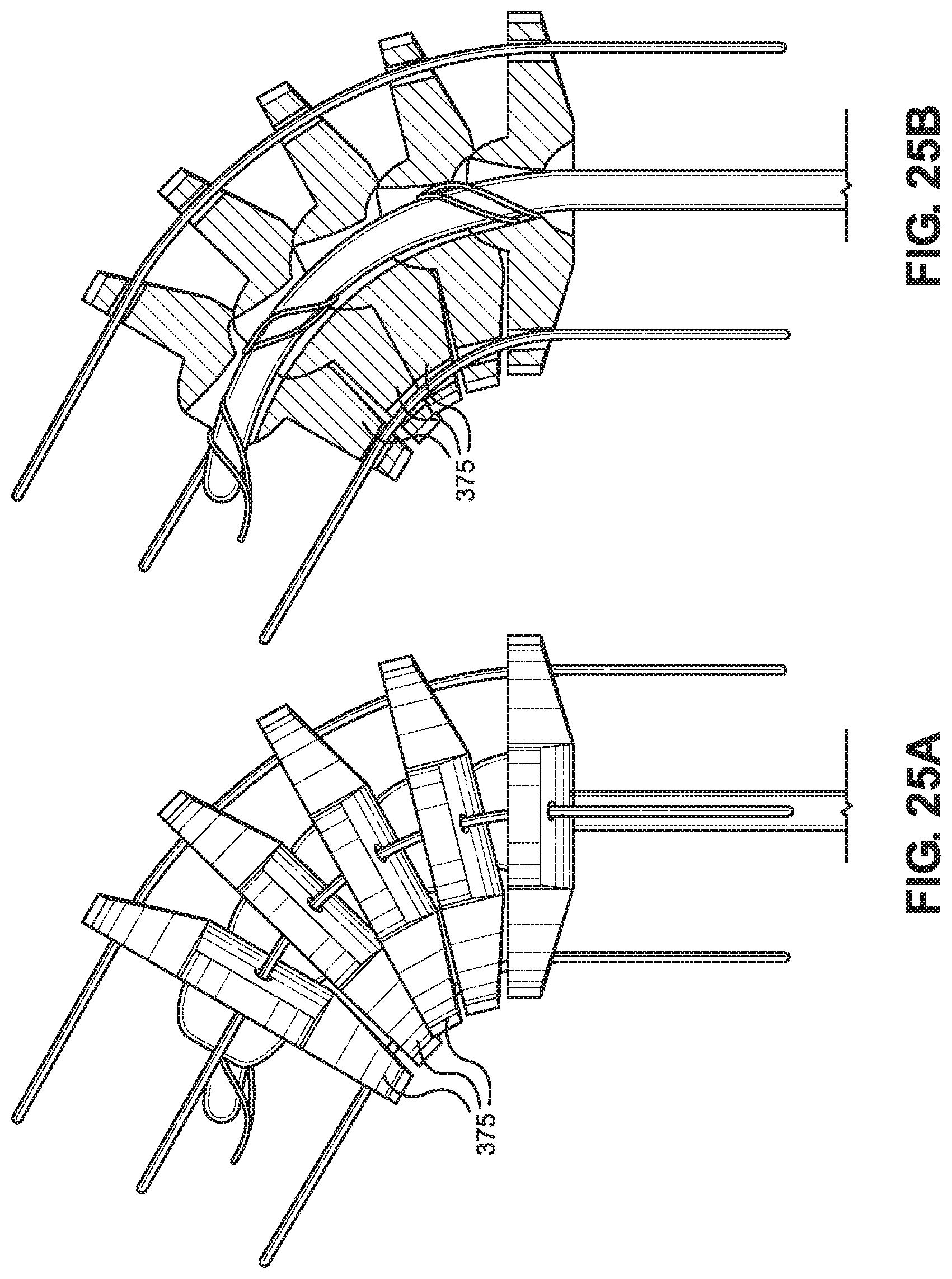 Patent US12310563 Figure 17 – Retrograde endoscope and method for performing intranasal endoscopy