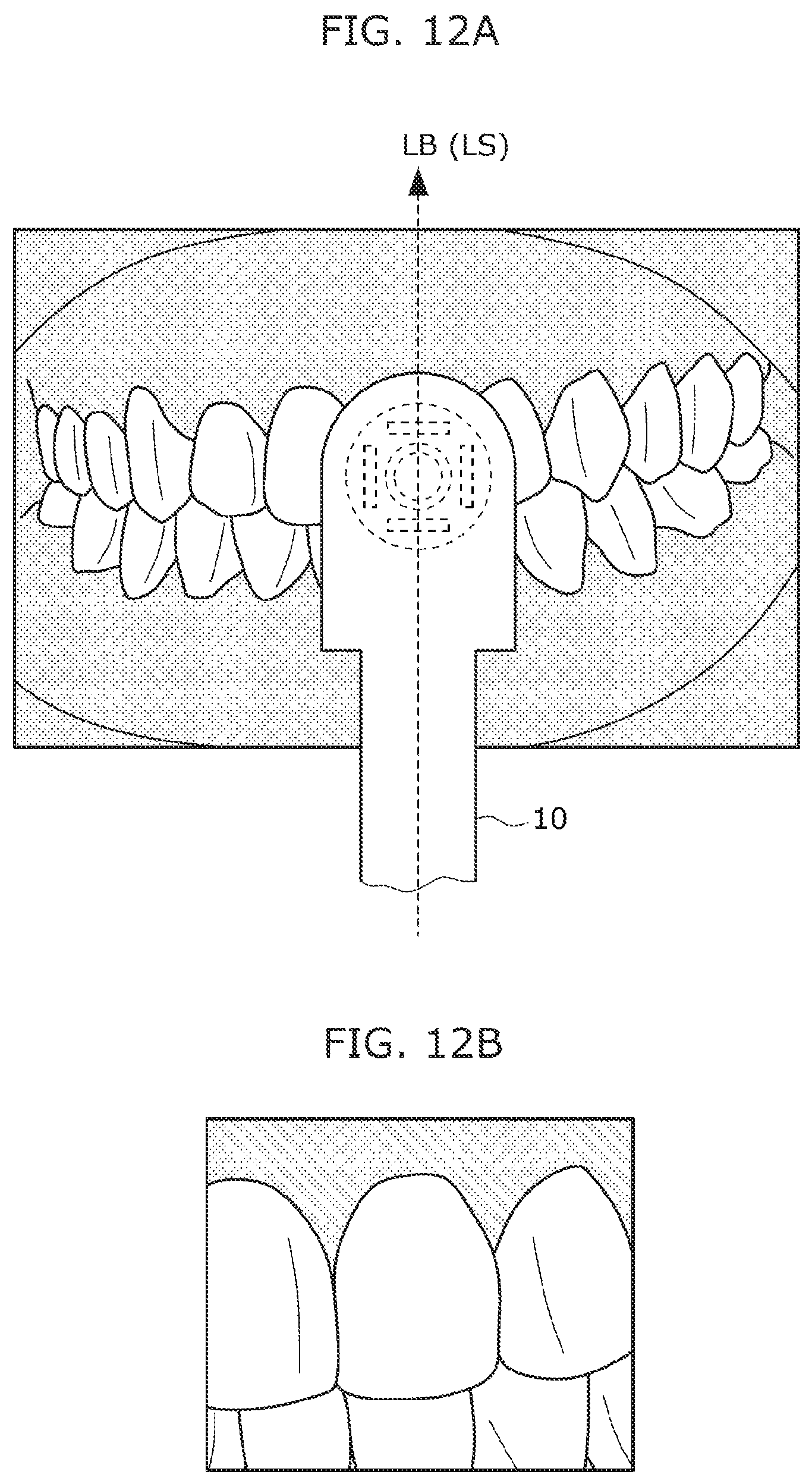 Patent US12310564 Figure 7 – Intraoral camera system and image display method