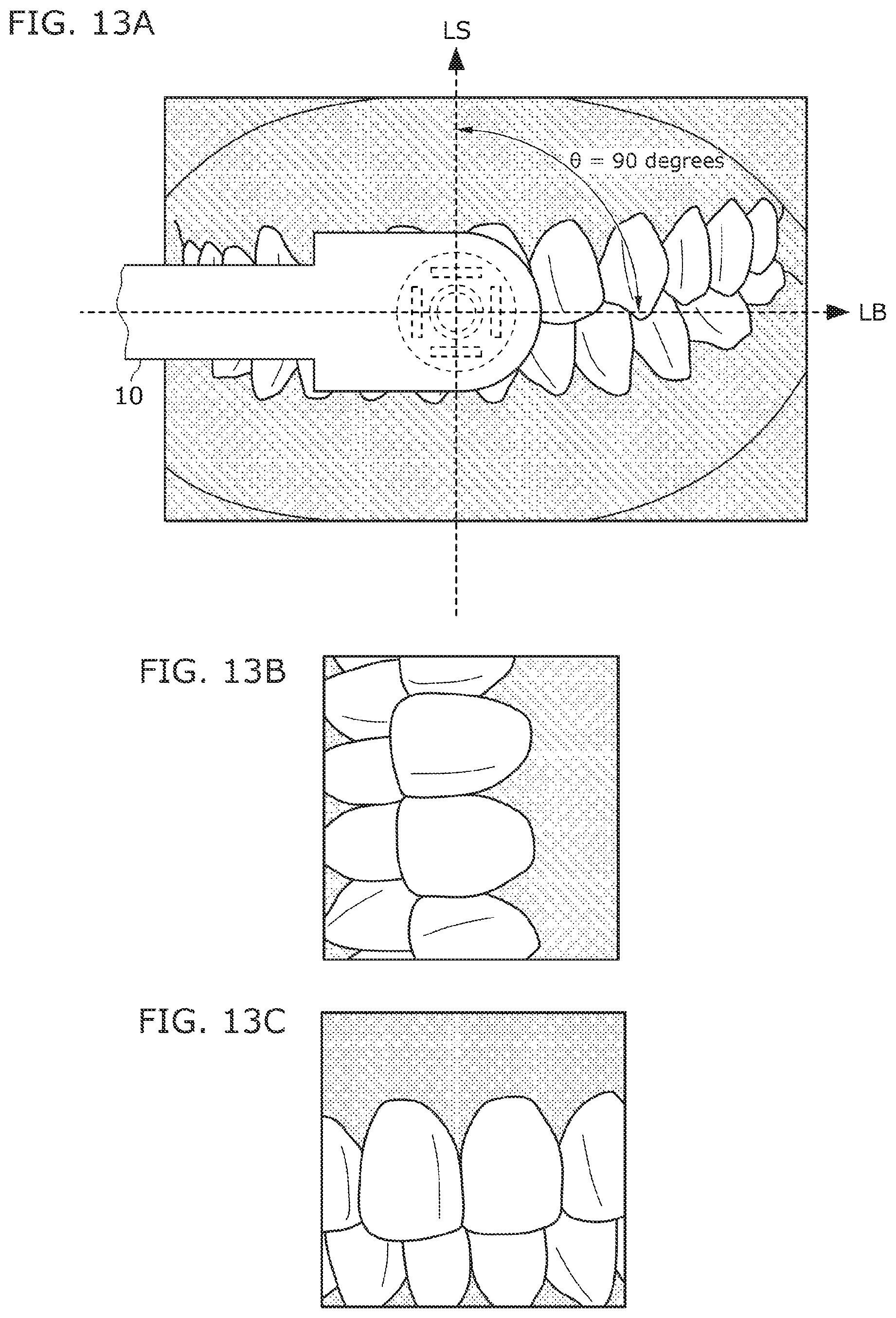 Patent US12310564 Figure 8 – Intraoral camera system and image display method