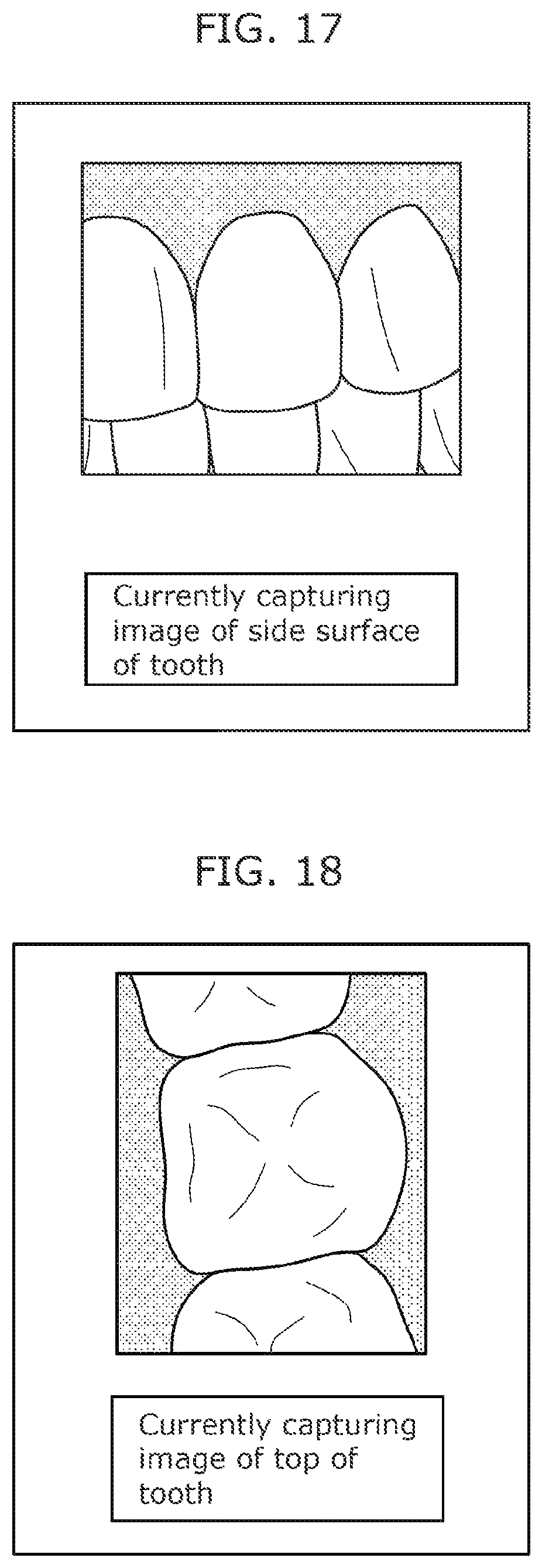 Patent US12310564 Figure 11 – Intraoral camera system and image display method