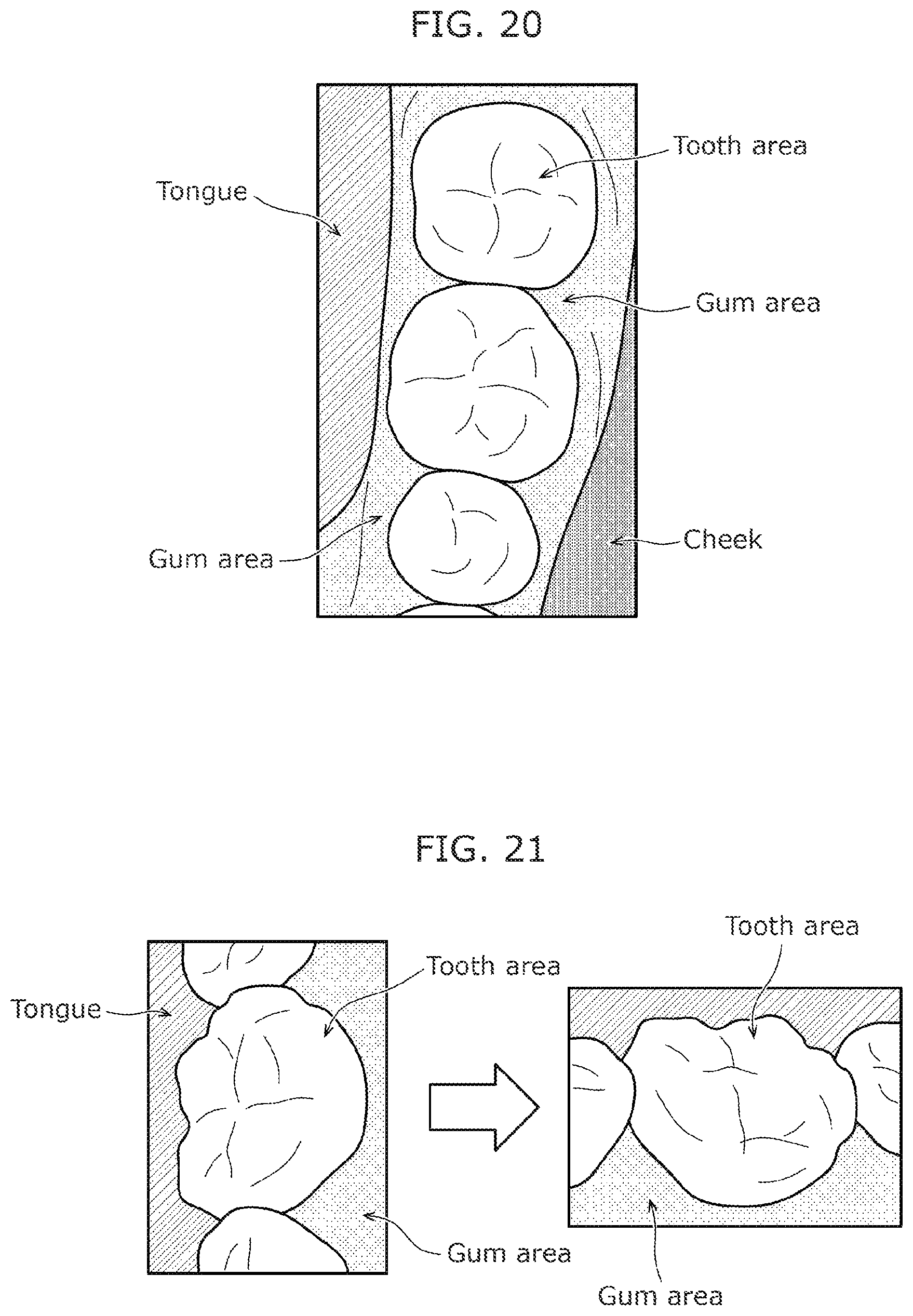 Patent US12310564 Figure 13 – Intraoral camera system and image display method