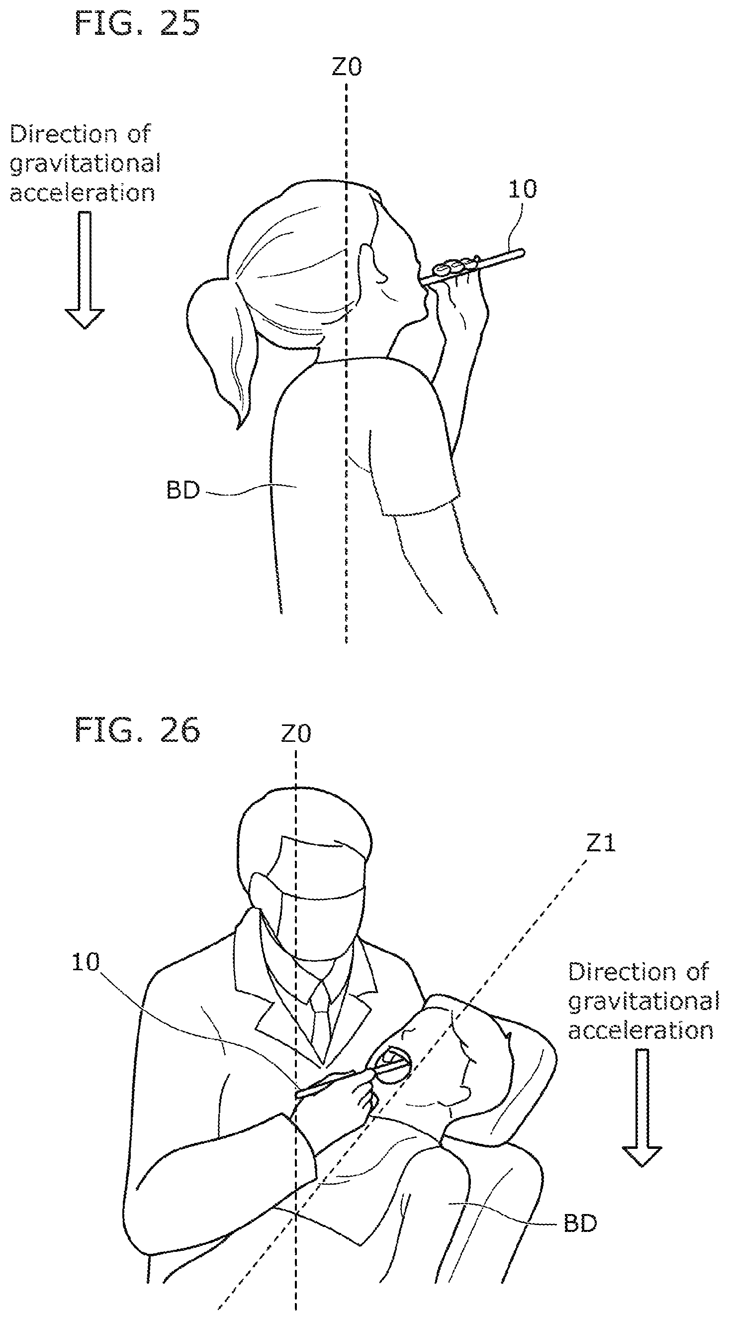 Patent US12310564 Figure 15 – Intraoral camera system and image display method