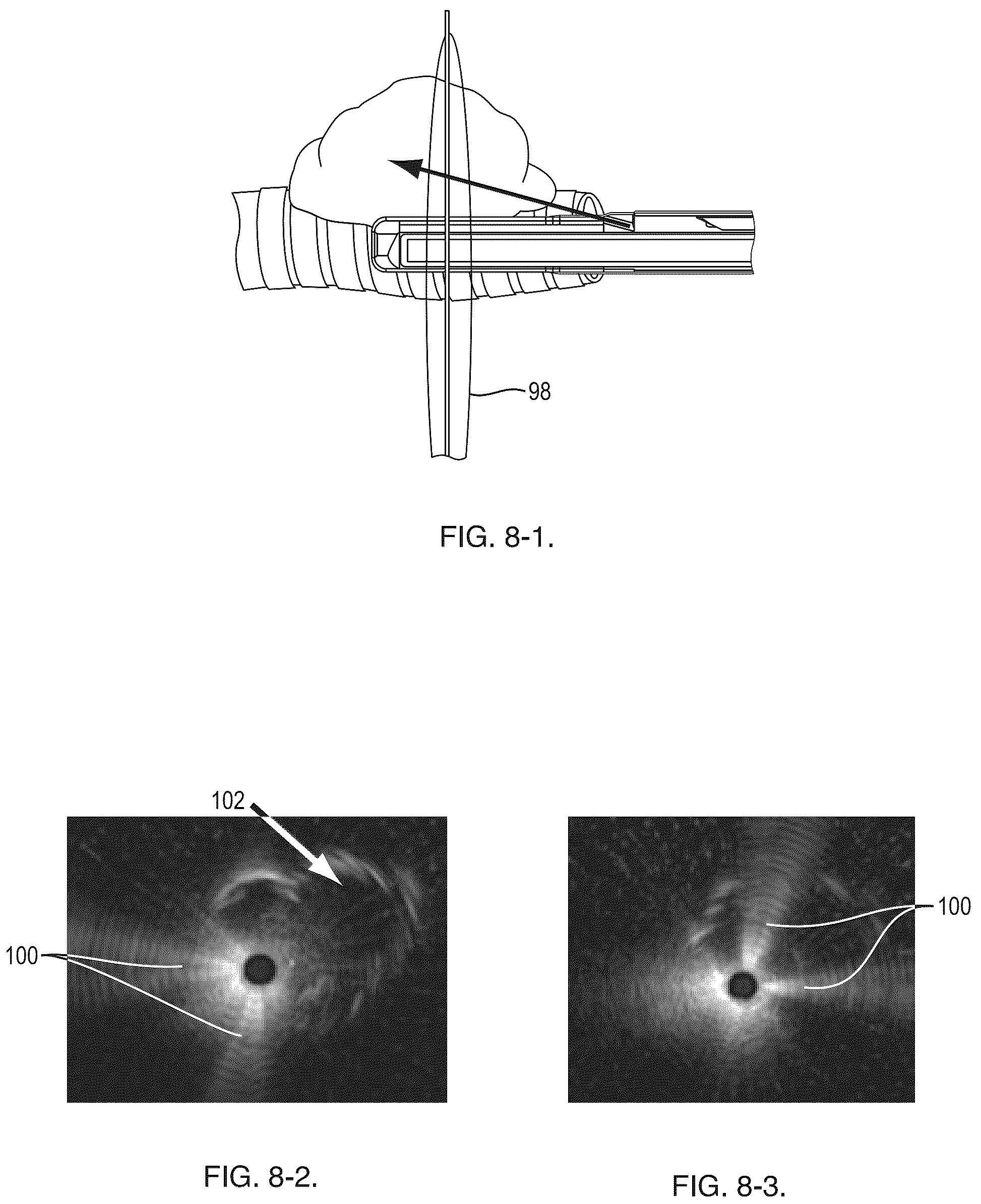 Patent US12310566 Figure 7 – Real-time sampling system