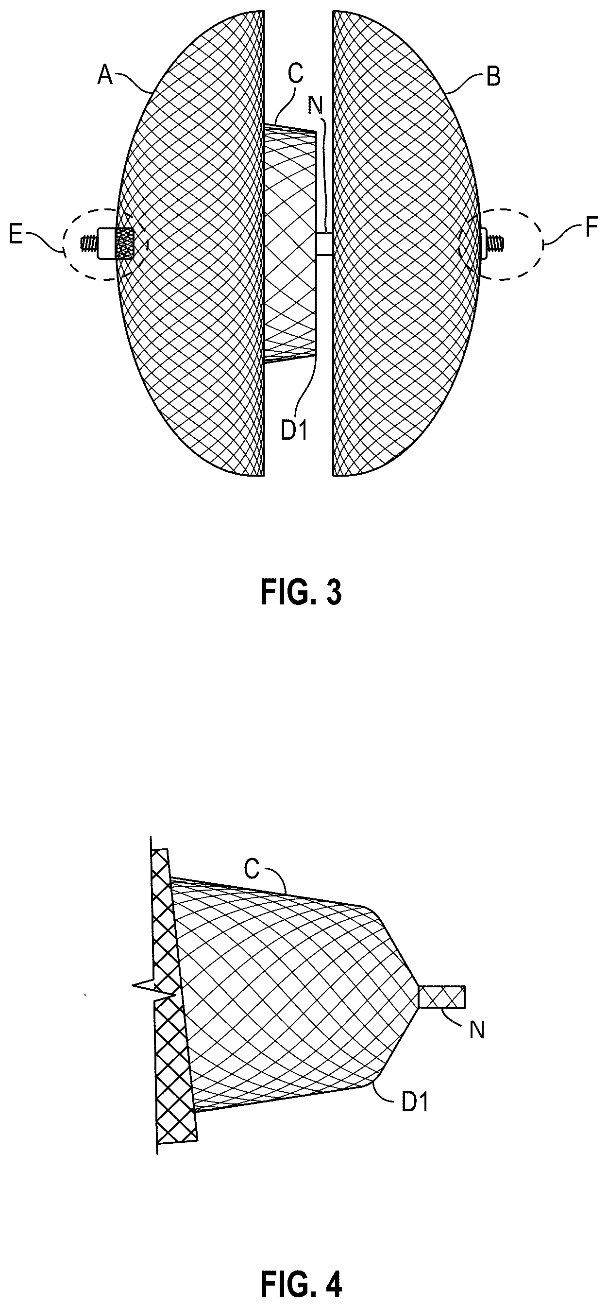 Patent US12310568 Figure 3 – Multi-functional occluder
