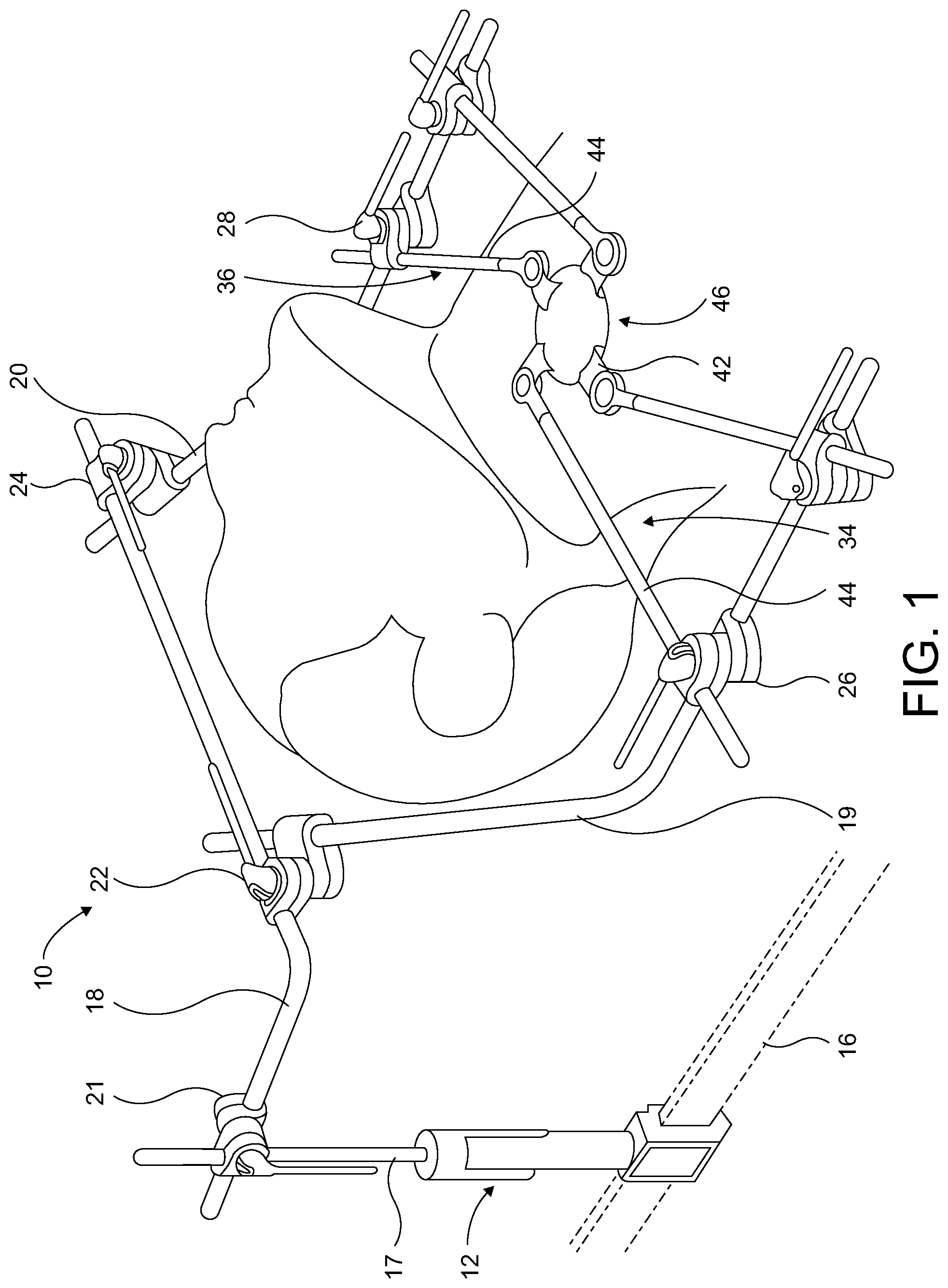 Patent US12310569 Figure 1 – Surgical retractor having clamping mechanism