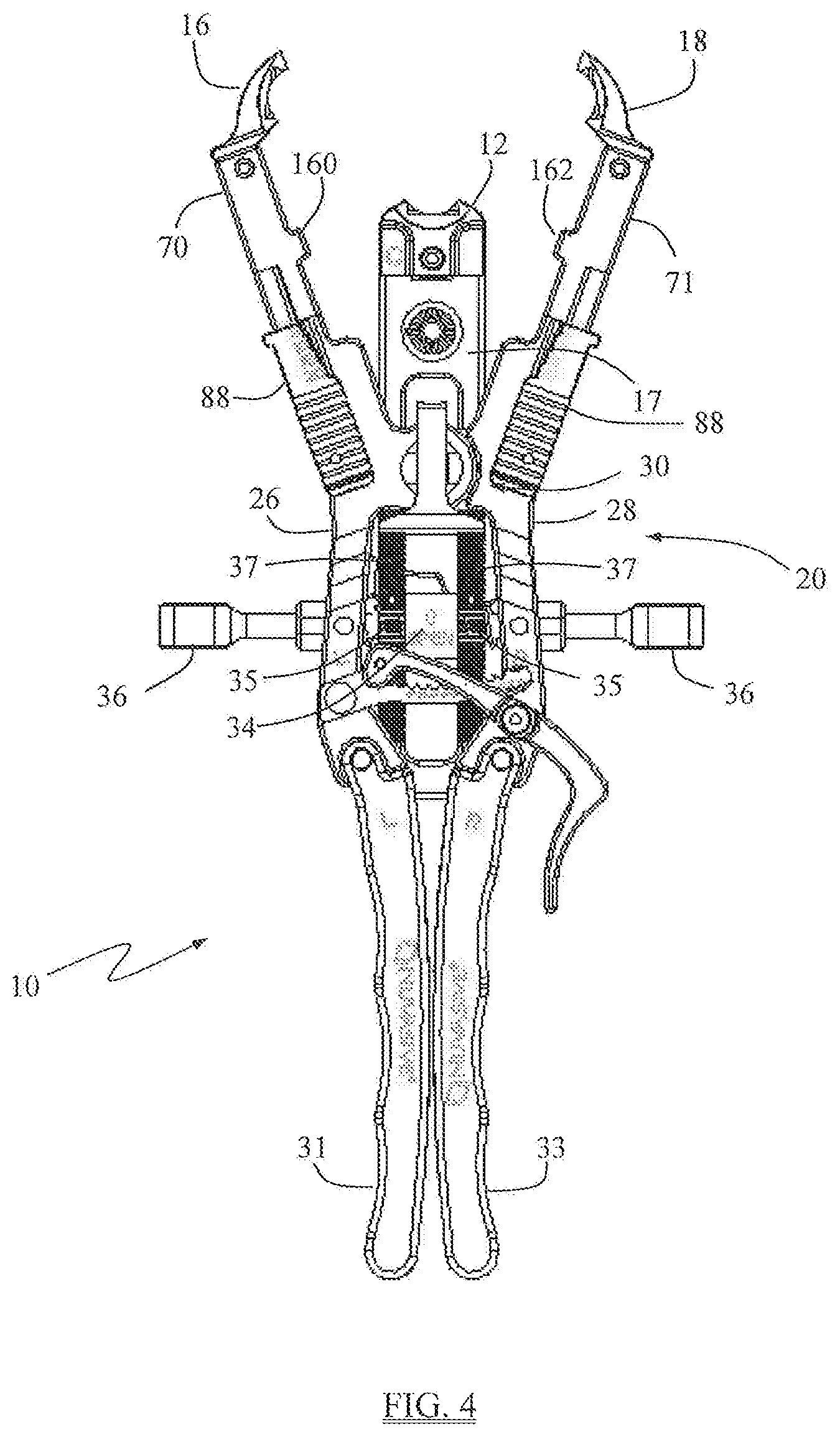 Patent US12310571 Figure 4 – Surgical access system and related methods