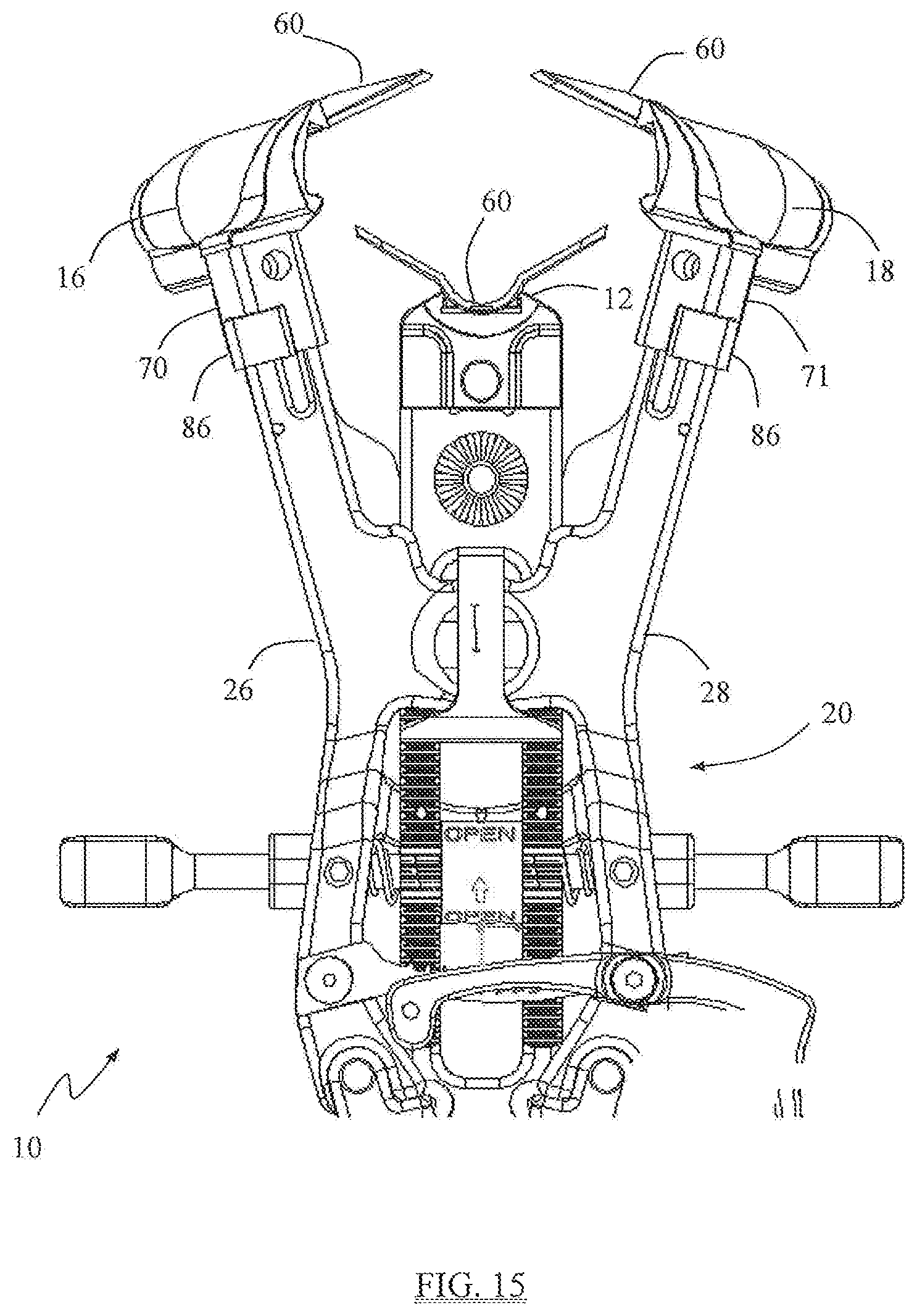 Patent US12310571 Figure 11 – Surgical access system and related methods