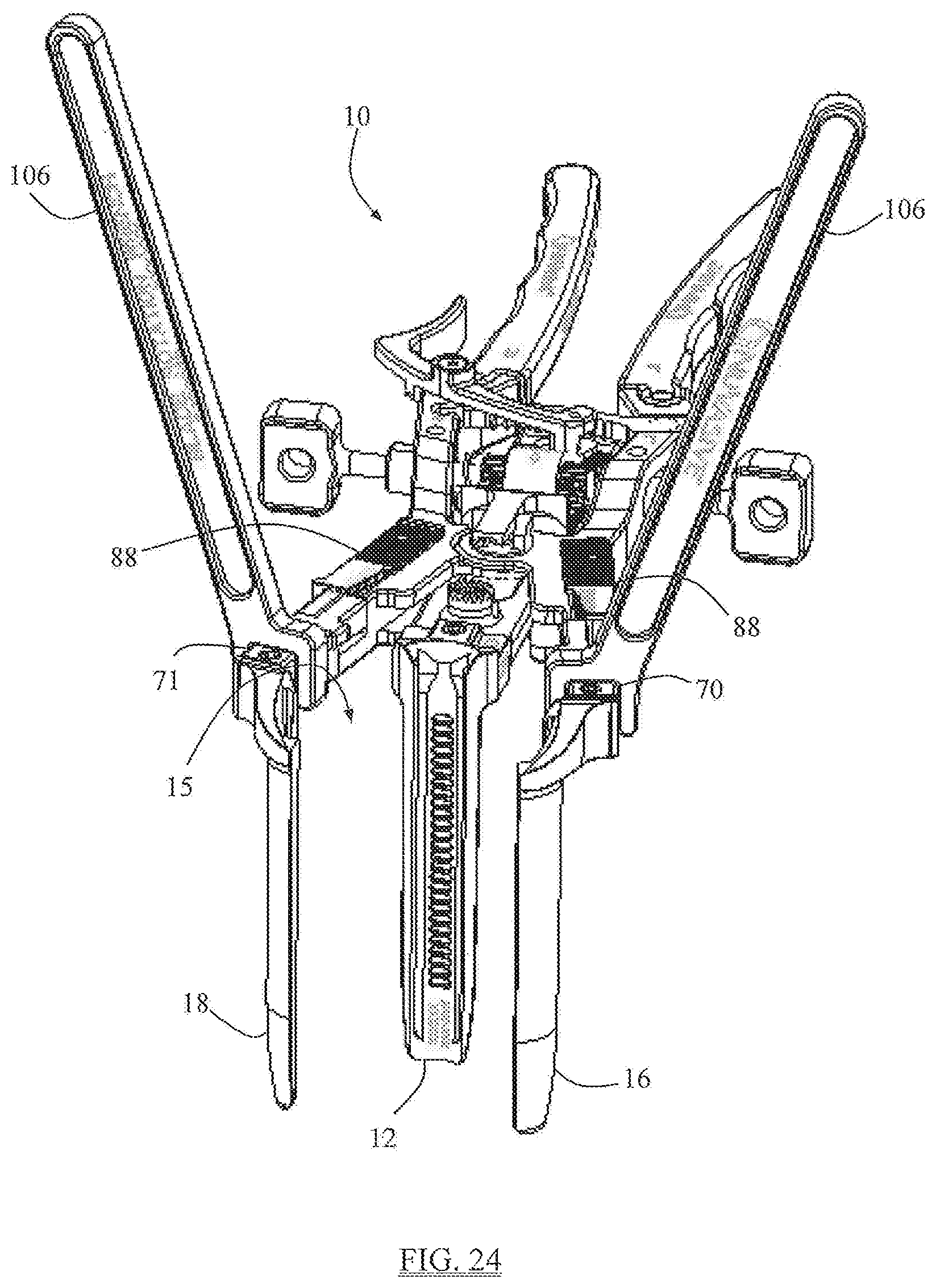 Patent US12310571 Figure 17 – Surgical access system and related methods