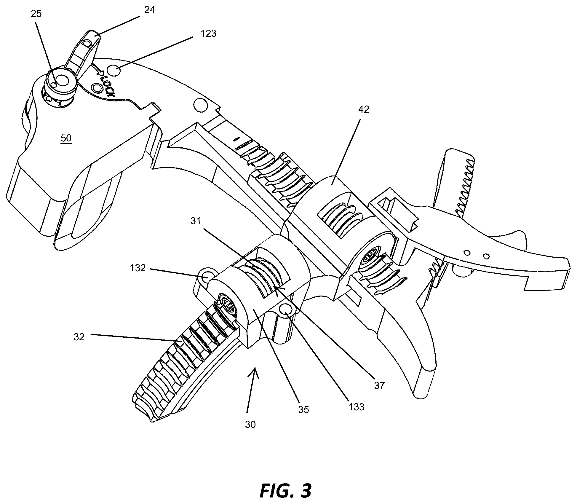 Patent US12310572 Figure 3 – Bone align and joint preparation device and method