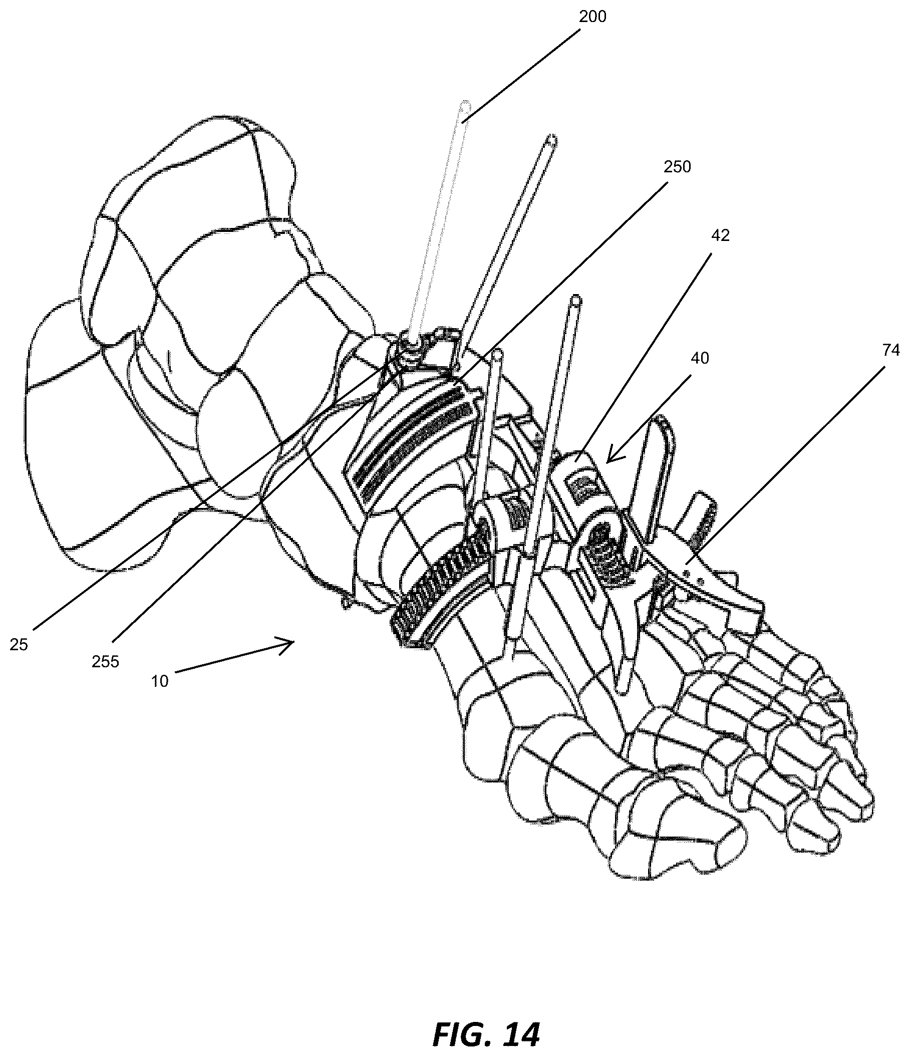 Patent US12310572 Figure 13 – Bone align and joint preparation device and method