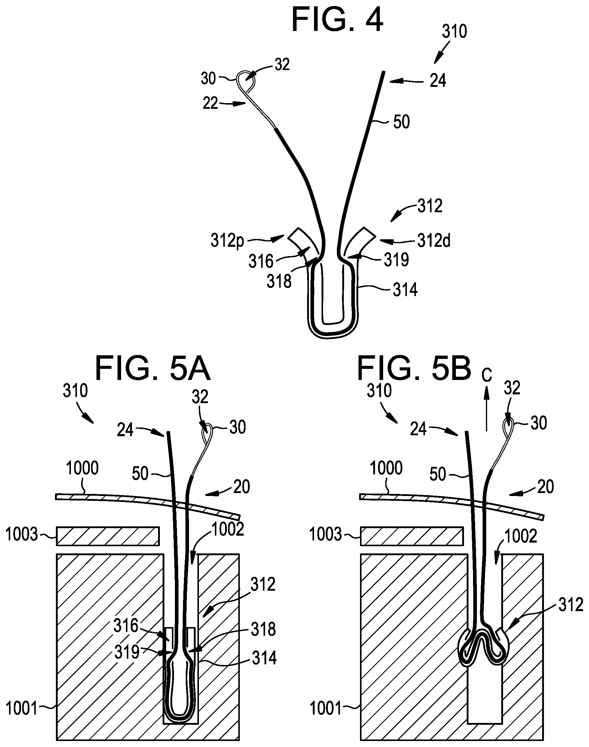 Patent US12310573 Figure 3 – Systems, devices, and methods for securing tissue using snare assemblies and soft anchors