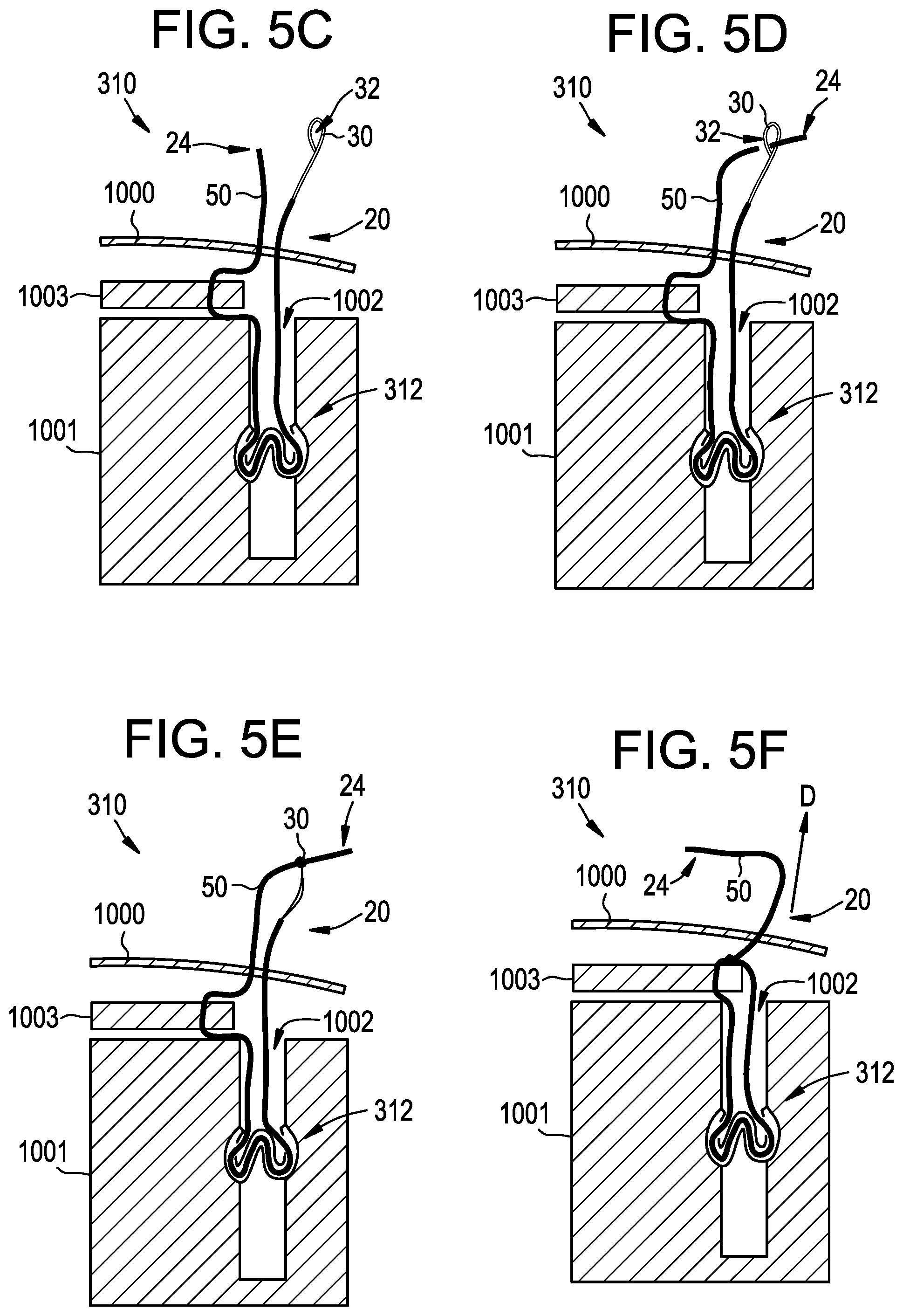 Patent US12310573 Figure 4 – Systems, devices, and methods for securing tissue using snare assemblies and soft anchors