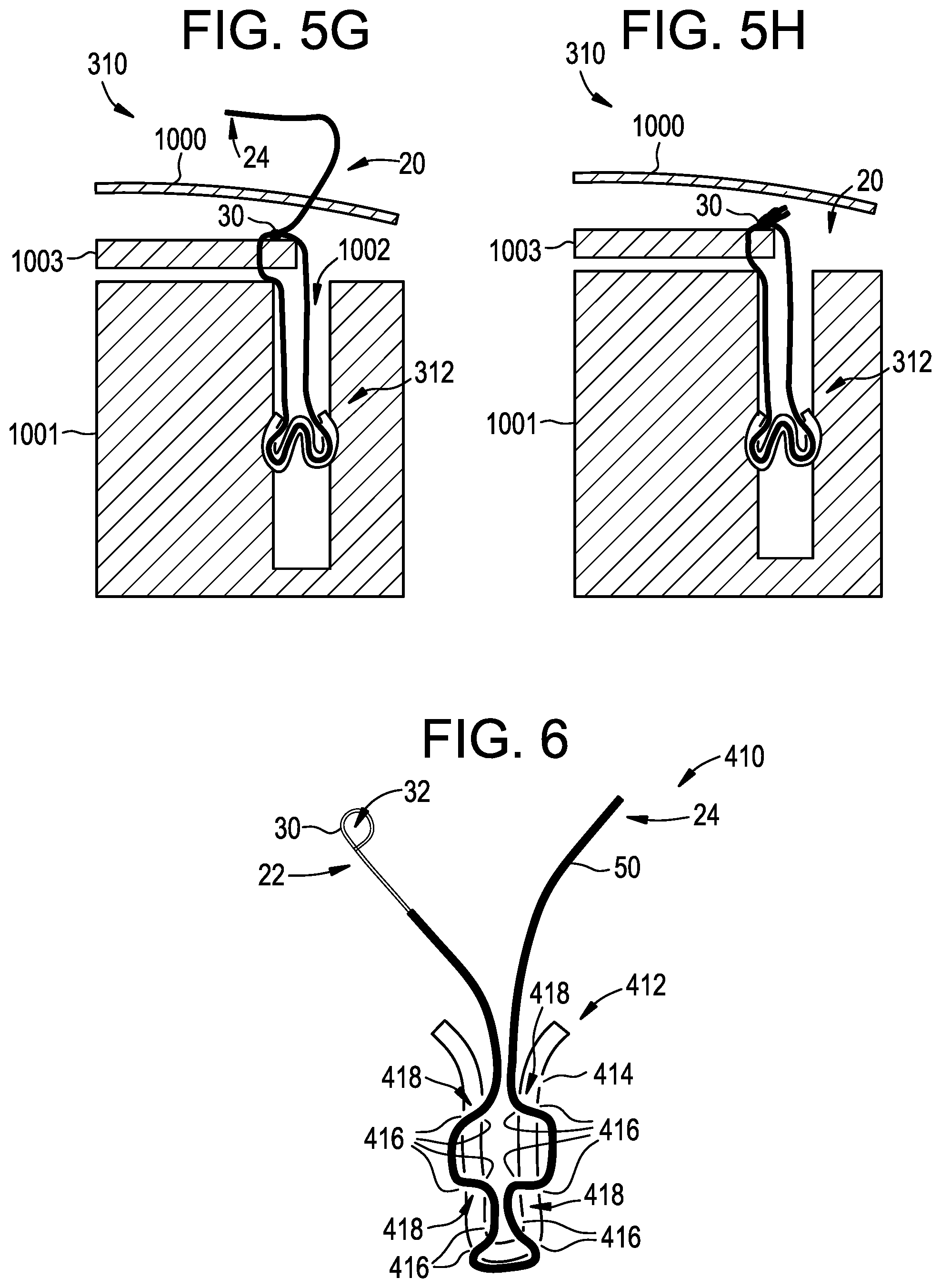 Patent US12310573 Figure 5 – Systems, devices, and methods for securing tissue using snare assemblies and soft anchors