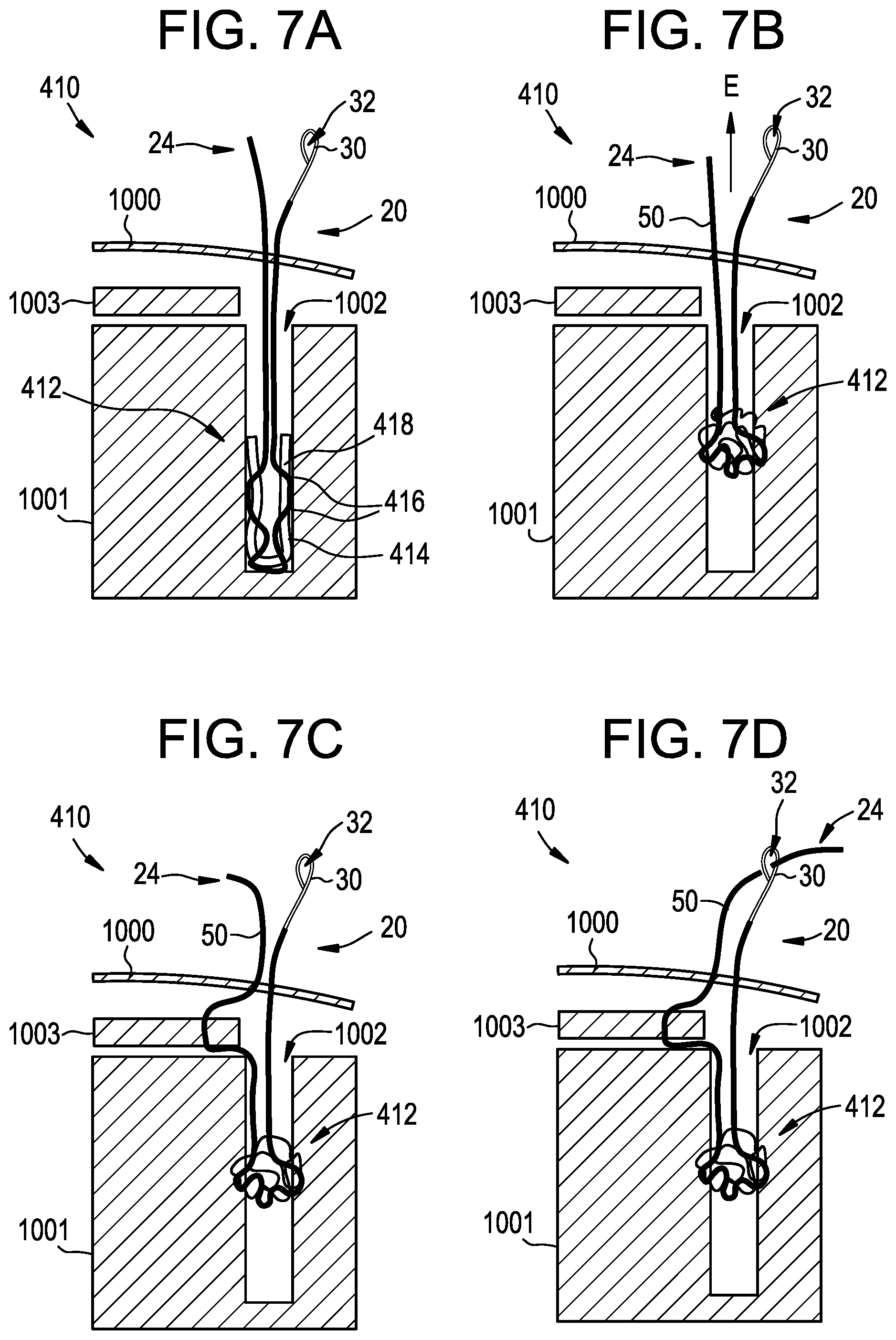 Patent US12310573 Figure 6 – Systems, devices, and methods for securing tissue using snare assemblies and soft anchors