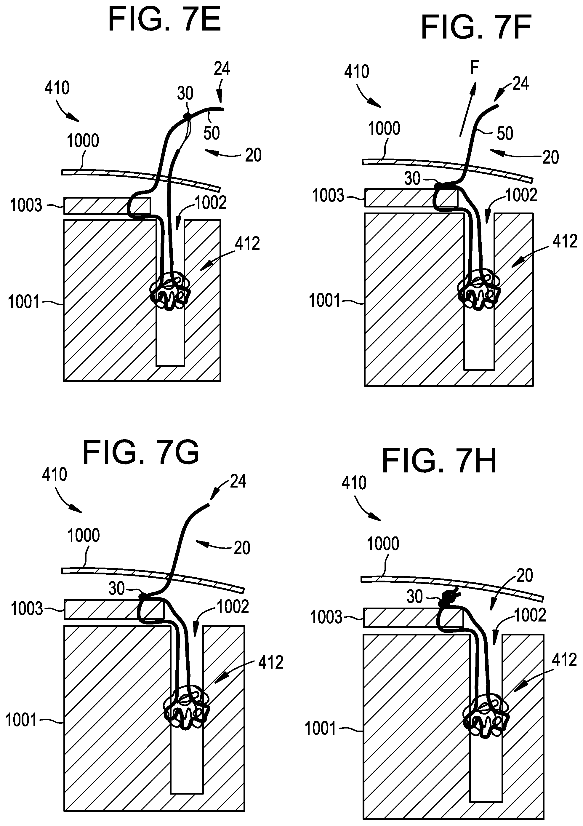 Patent US12310573 Figure 7 – Systems, devices, and methods for securing tissue using snare assemblies and soft anchors