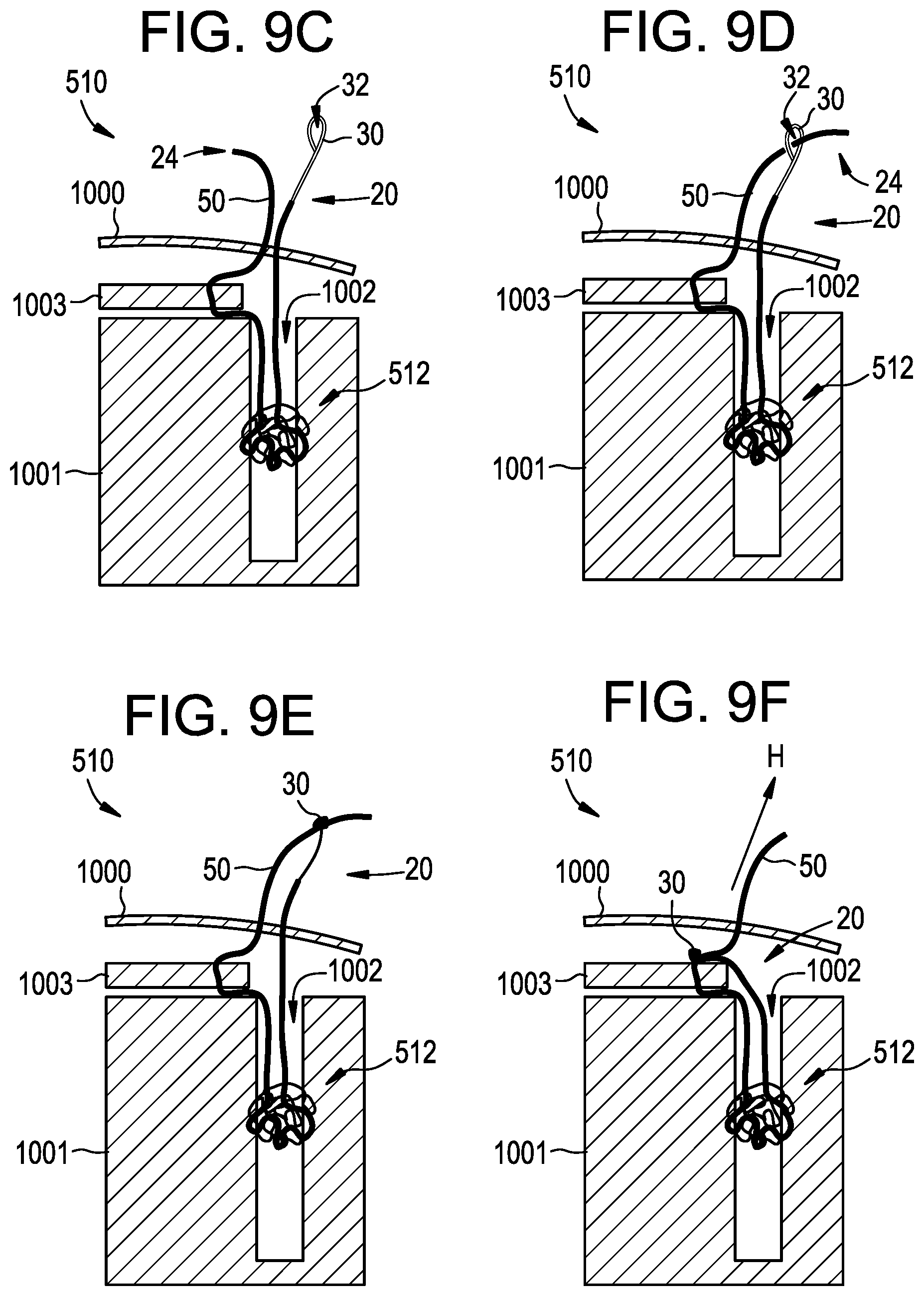 Patent US12310573 Figure 9 – Systems, devices, and methods for securing tissue using snare assemblies and soft anchors